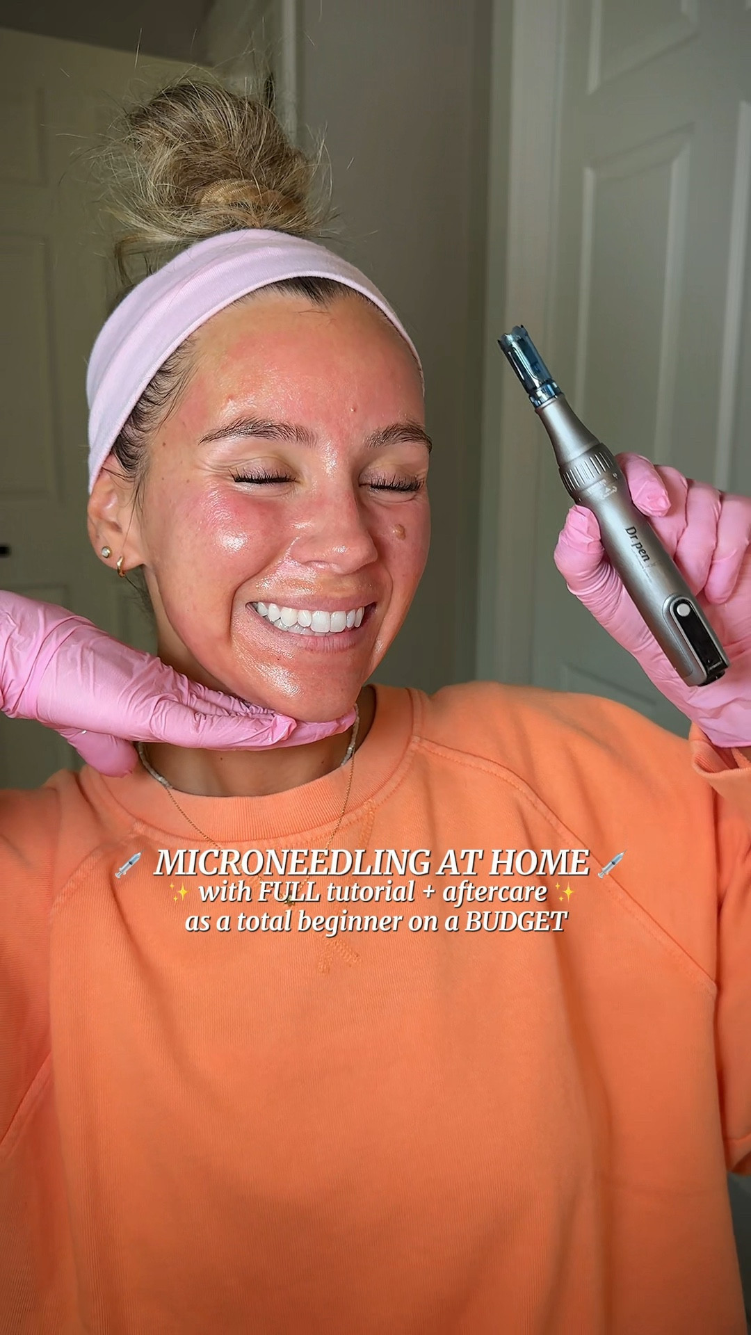 My 6th Home Microneedling Treatment! I’ve been LOVING the results! ✨ 💉 
This video is step x step how to microneedle safely at home, should answer all beginner questions and show you everything you need that’s affordable!! 

#LTKBeauty #LTKmorningroutine #LTKselfcare