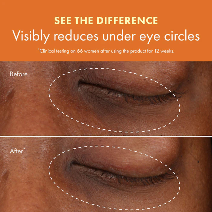 Ginzing™ Vitamin C Eye Cream to Brighten and Depuff | Sephora (CA)