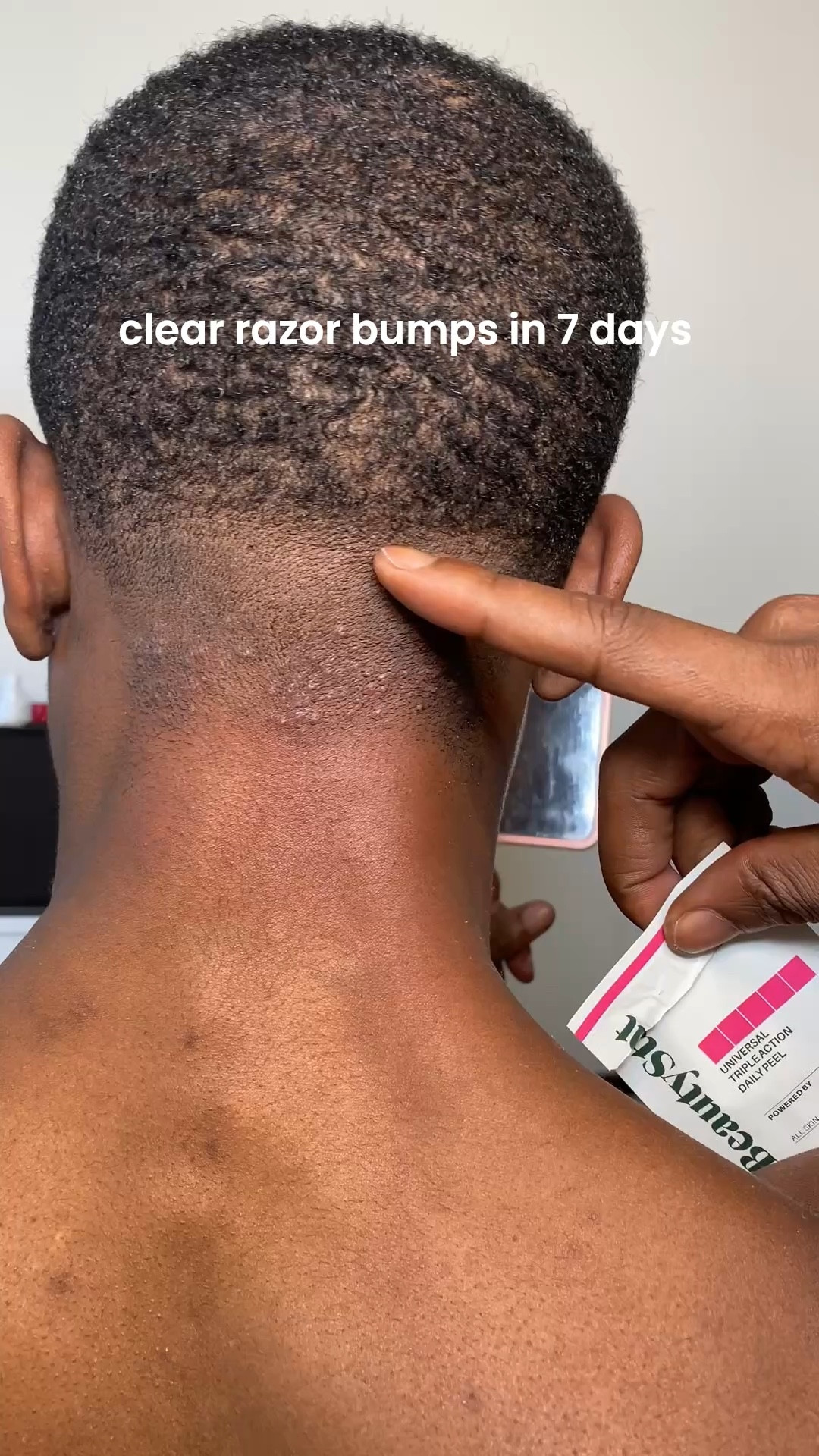 Clear razor bumps in 7 days 

#LTKBeauty