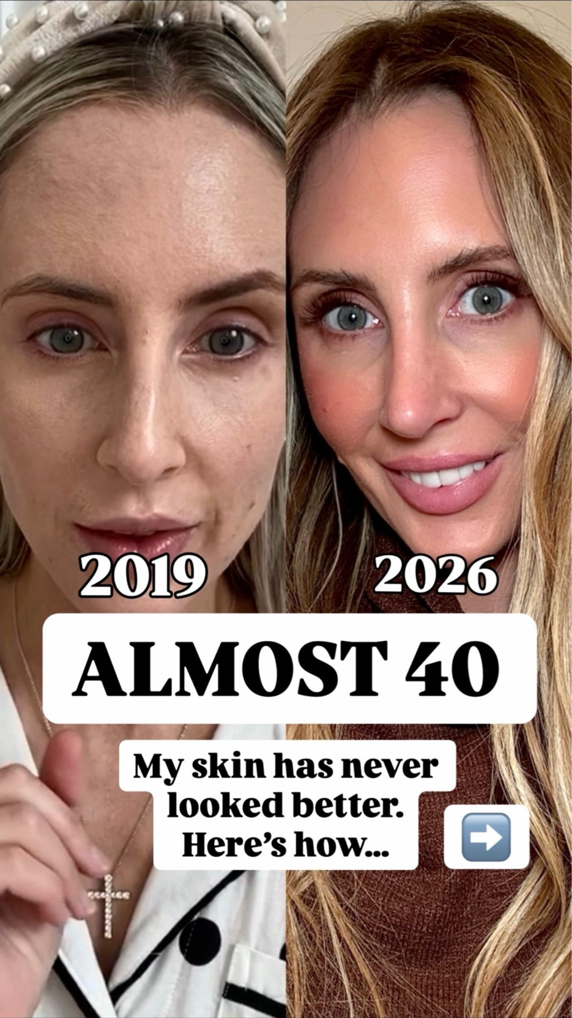 My skin has never looked better… here’s how

foundation shade: tawny
