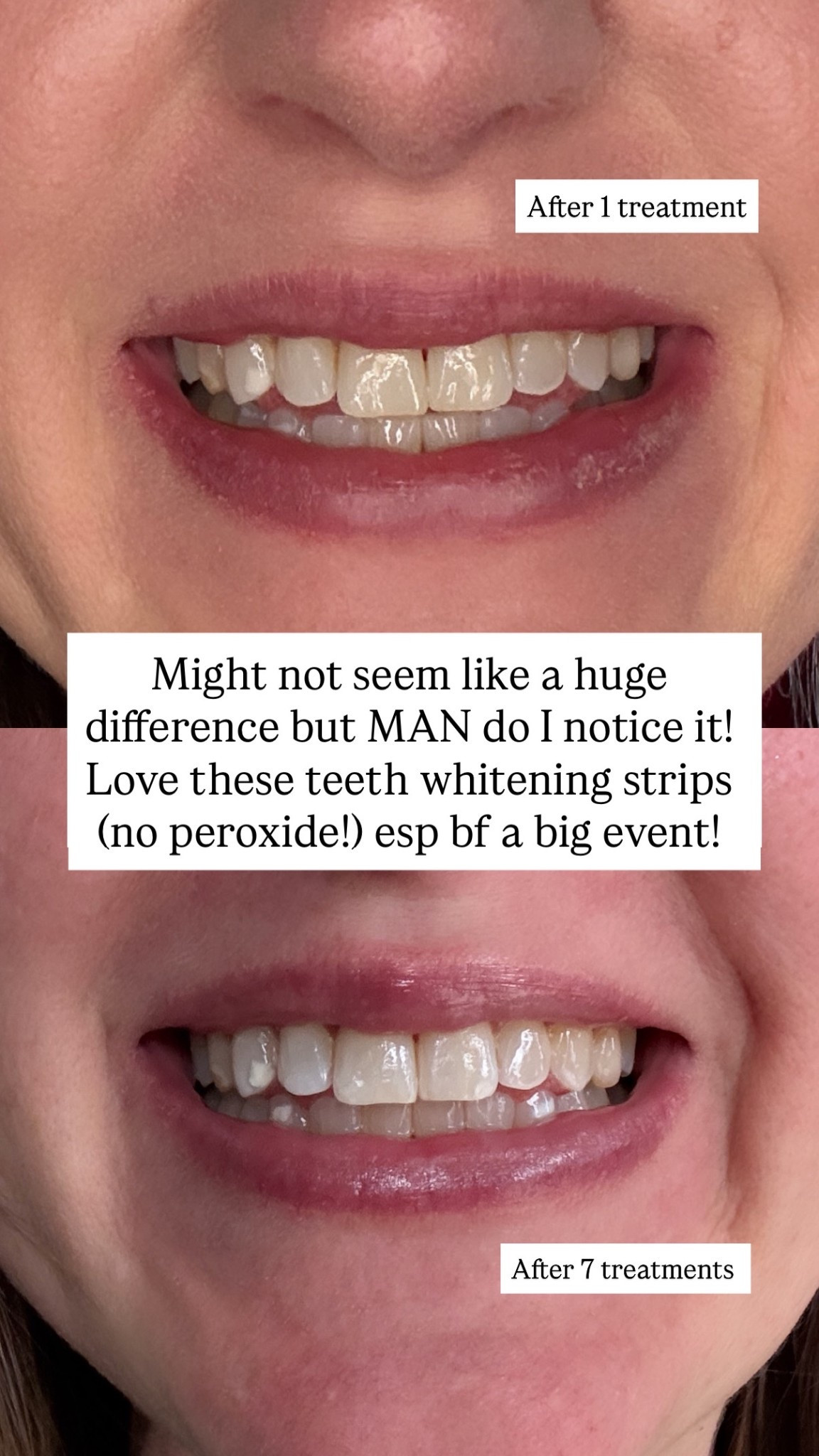 These are my fave teeth whitening strips for sensitive teeth! Currently on sale AND arrive well before the holidays so you get get your pearly whites ready! 🥰

#LTKmorningroutine #LTKHoliday #LTKselfcare