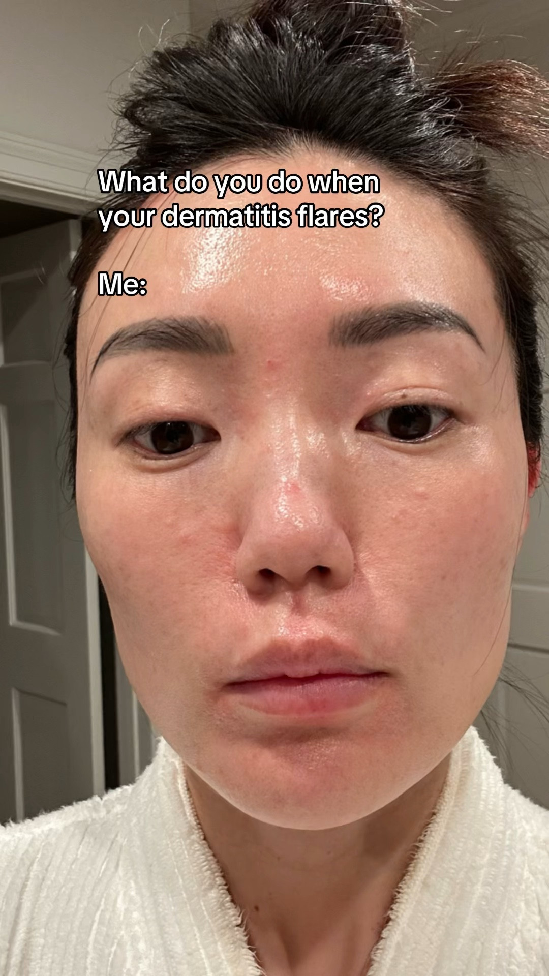 These products help with my dermatitis  