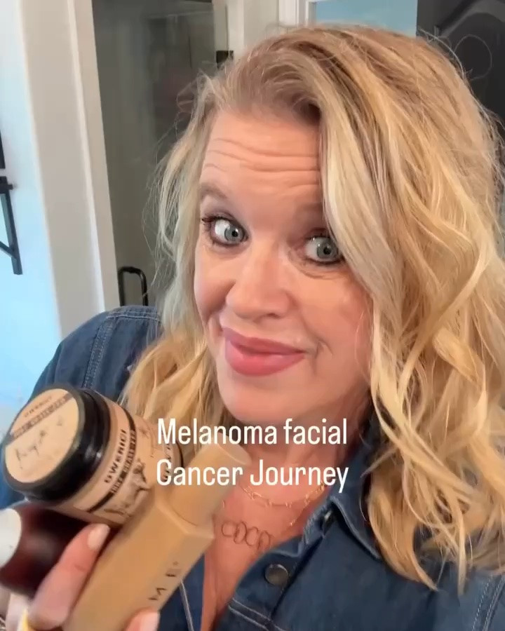 Melanoma Facial Cancer Journey
Part 9

6 Clean Beauty products I used up and loved so much I reordered.
 
Being diagnosed with Melanoma Facial cancer in December, has been quite the journey, to say the least! Leaving me with a facial scar from my eye to my jaw, and really left me wanting to learn more about Melanoma, what causes this deadly cancer and ways to heal, protect myself, and hopefully help others.

1 part of this journey was to clean up my beauty products, as our skin is our biggest living organ and woman put deadly unhealthy products on it and in it every single day.

6 Clean Vegan and organic Beauty products I loved & reordered: 

-100% Grass Fed whipped Tallow cream
Super hydrating and great moisturizer 
- The Standard Hair oil is a must for healthy hair
-SPF 30 Tinted moisturizer 
—Best seller Perfume that gets you compliments 
- sunless tan anti aging serum
-Super Serum hydrating and leaves your skin feeling silky.

Comment “Shop” for links
⬇️

Want to know more about my journey… the How, Why, The process and what I’ve changed… I have 8 other detailed post up in my feed, and a highlight tab …Sharing my supplements , my daily clean green drink, my beauty and make up routine, our house hold cleaning products, What really is causing melanoma (and it’s NOT the sun) what we use- how I completely cleaned up our families diet (even though we eat really organic and healthy and removed All plastics from our home. Along with the complete Melanoma journey from diagnosis- surgery-detailed steps and healing..

My 4th Laser surgery needed for the healing processes is coming up soon.

Melanoma cancer| beauty| Skin cancer | over 50 | utah content creator

#LTKselfcare #LTKOver40 #LTKBeauty