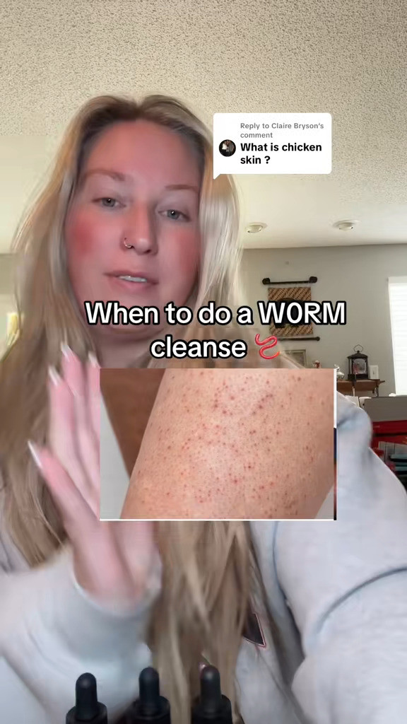 gut cleanse, parasites, gut health, kids supplements, detox, cleanse 

 #LTKmomlife #LTKstorytime #LTKKids