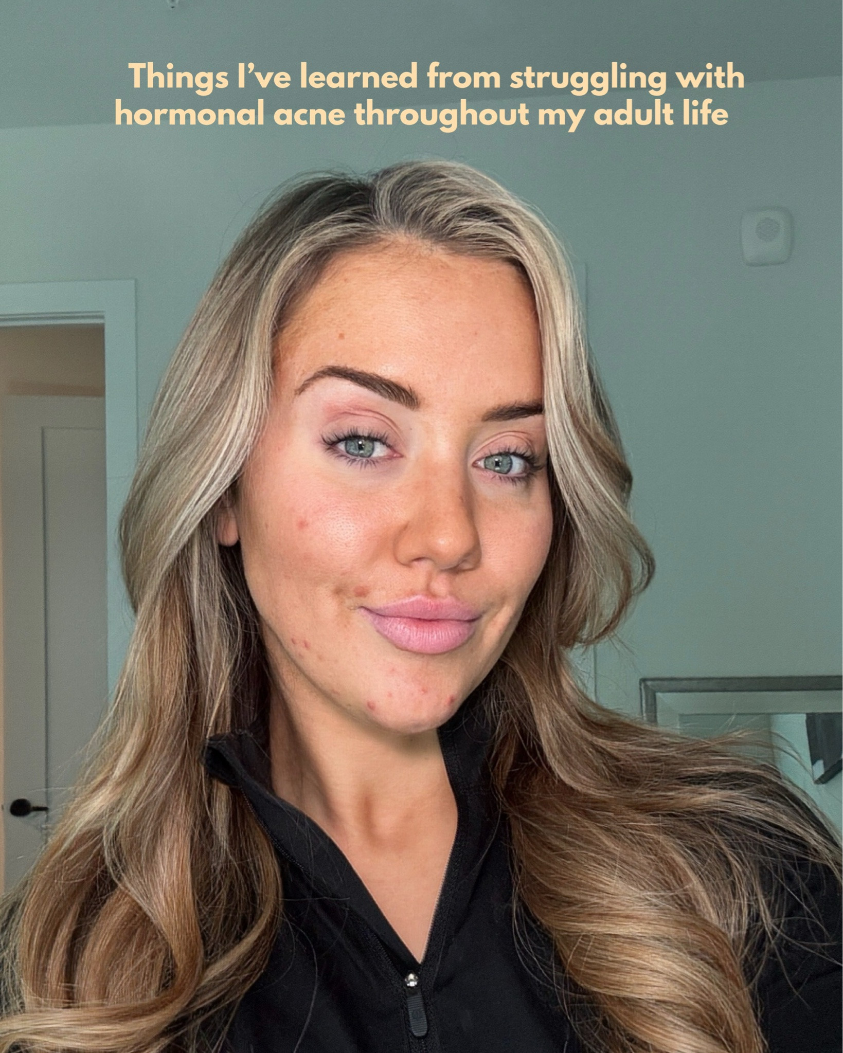 Products that have really helped me with my hormonal acne journey 💙