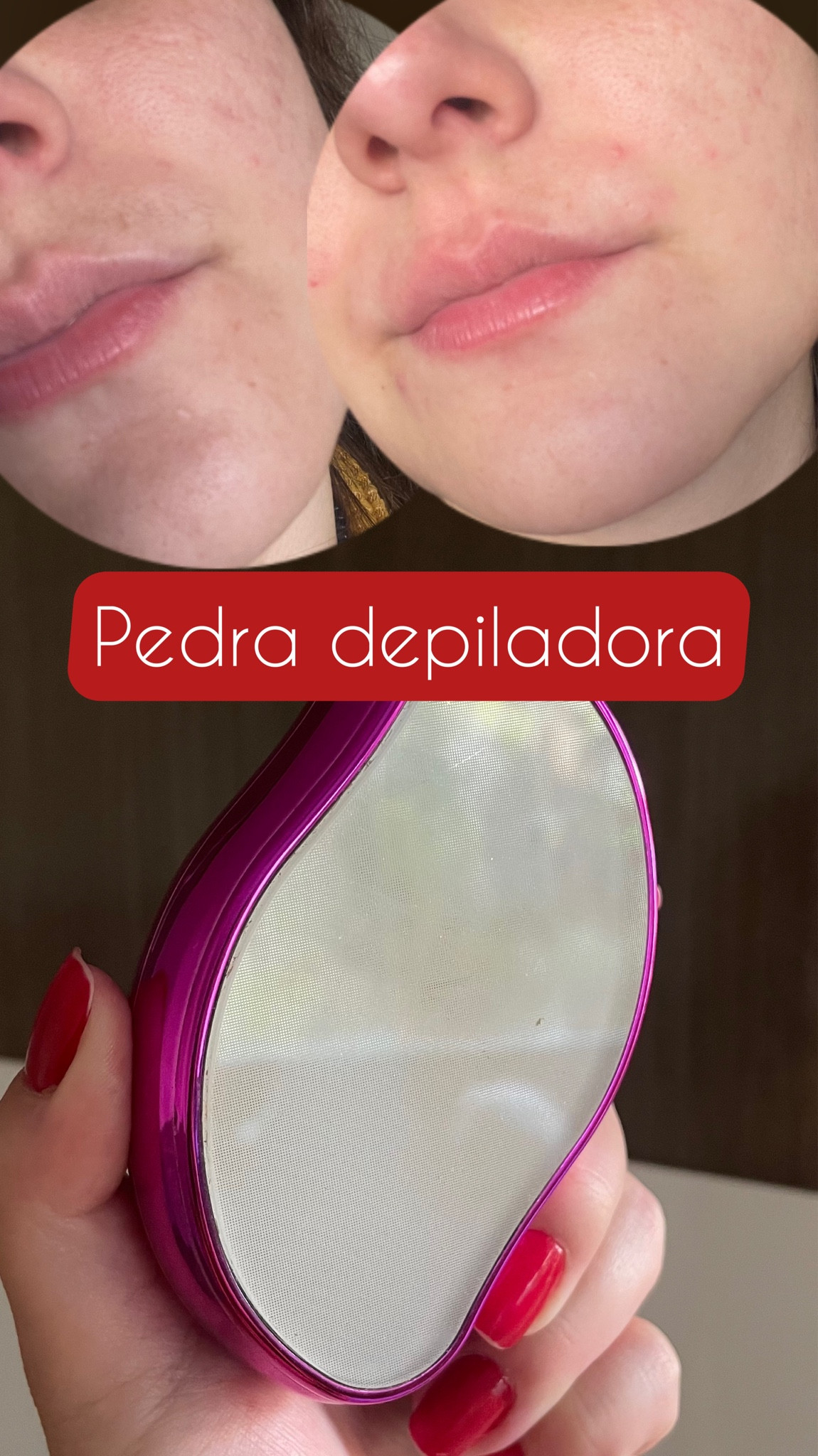 A pedra depiladora é ótima para regiões pequenas e pelos finos. 
O único lugar que eu consigo usar é no buço
✅ Retira os pelos 
✅ Esfolia

Coloquei no post os melhores lugares pra você comprar a sua também 🩷

#LTKbrasil #LTKbeauty