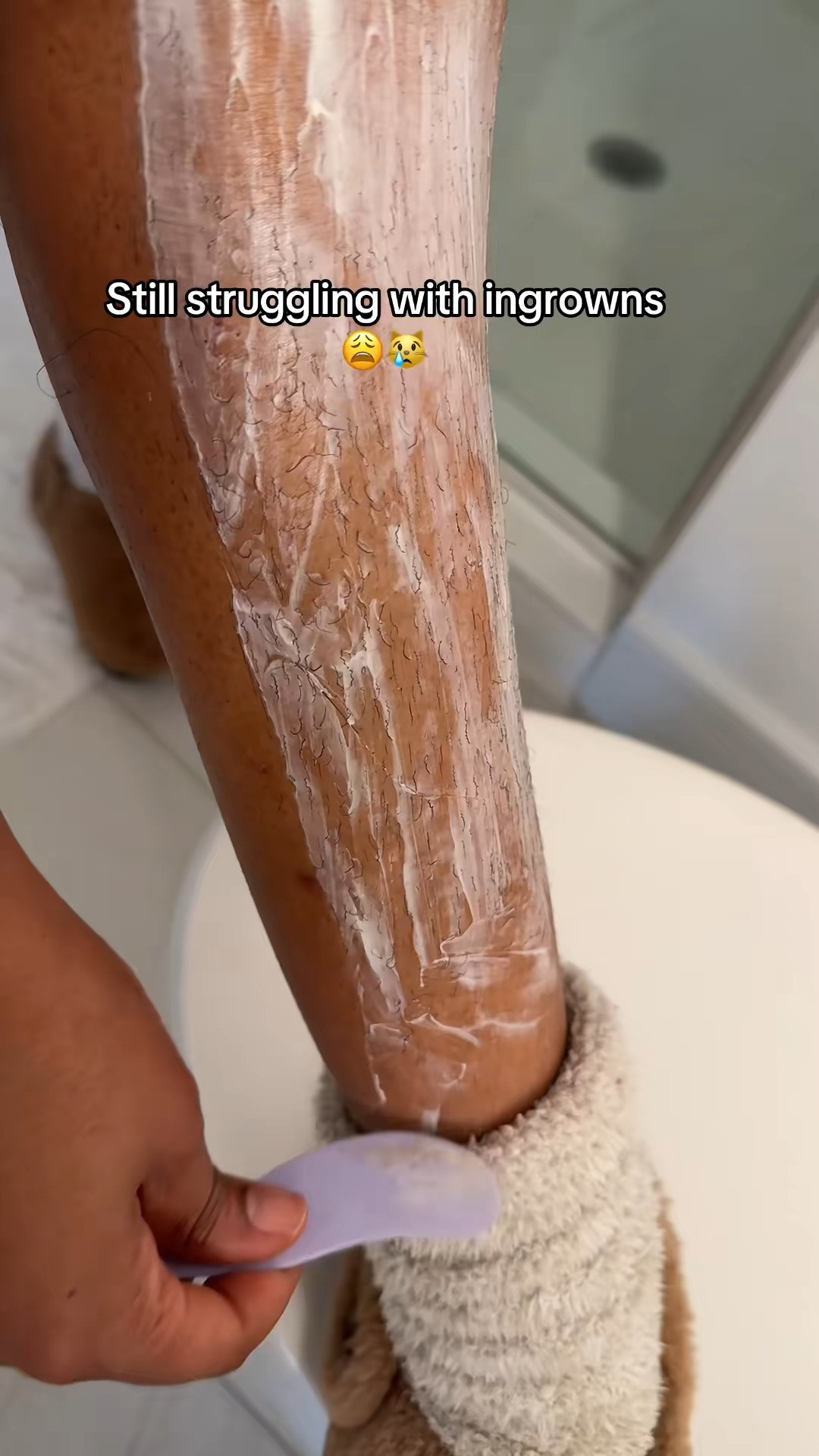 Right in time for summer this helped clear up my ingrowns & irritation from years of shaving @Flamingo 

 #LTKselfcare #LTKSaleAlert #LTKBeauty