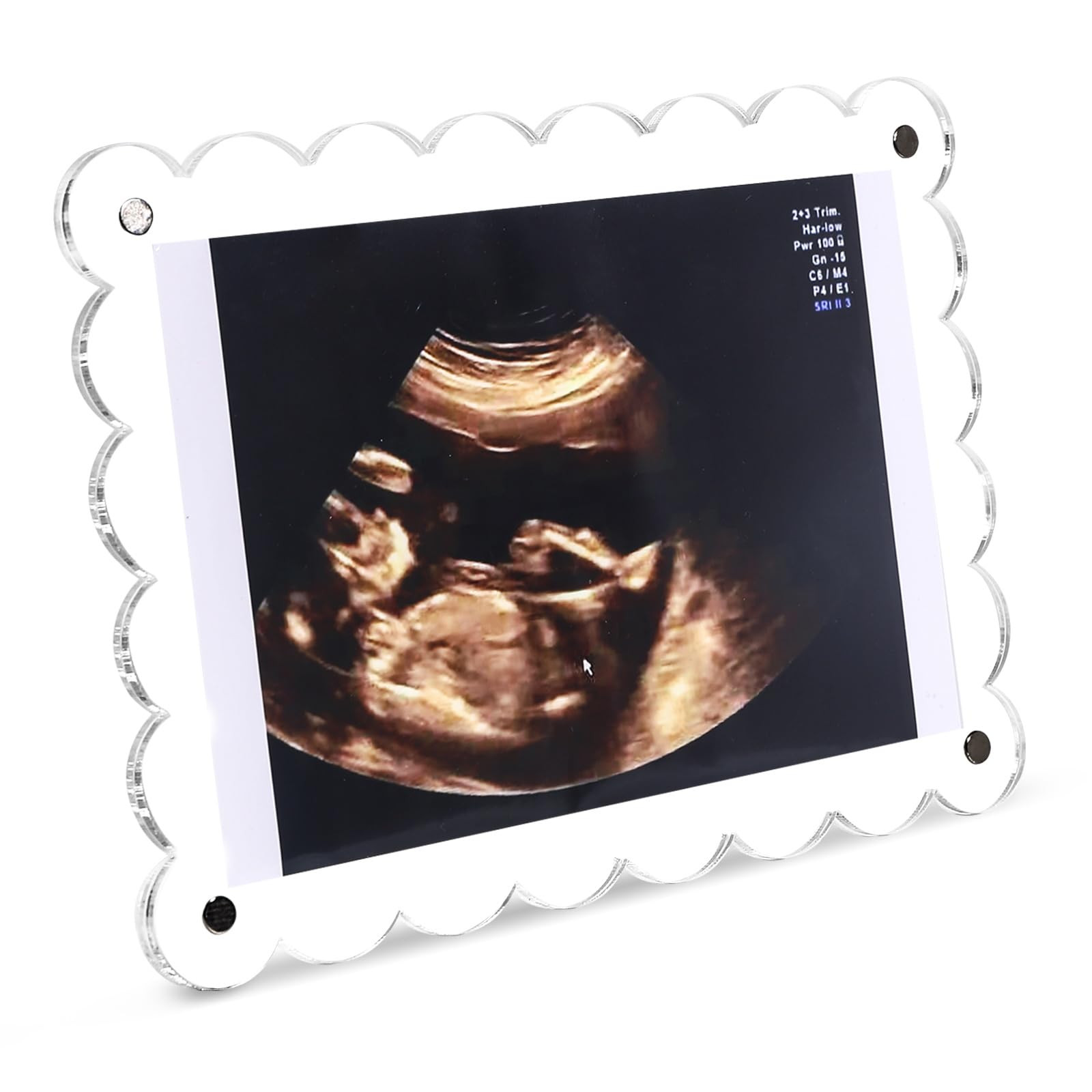 Magnetic Clear Acrylic Scalloped Baby Ultrasound Picture Frame - Sonogram Frame for Refrigerator,... | Amazon (US)