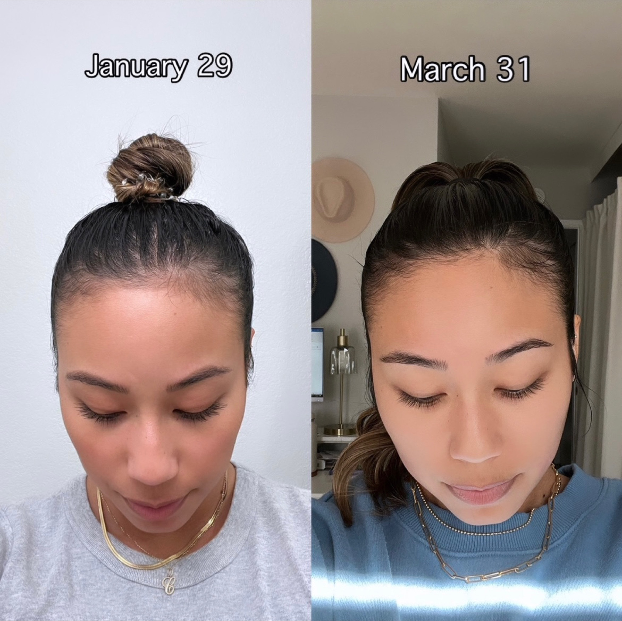 rosemary mint hair oil that changed the game! thickened my hair in 3 months and I let it soak before I shower and double shampoo. I use it 2-3x a week | thin hair product | fine hair product | rosemary oil | hair care 

#LTKbeauty