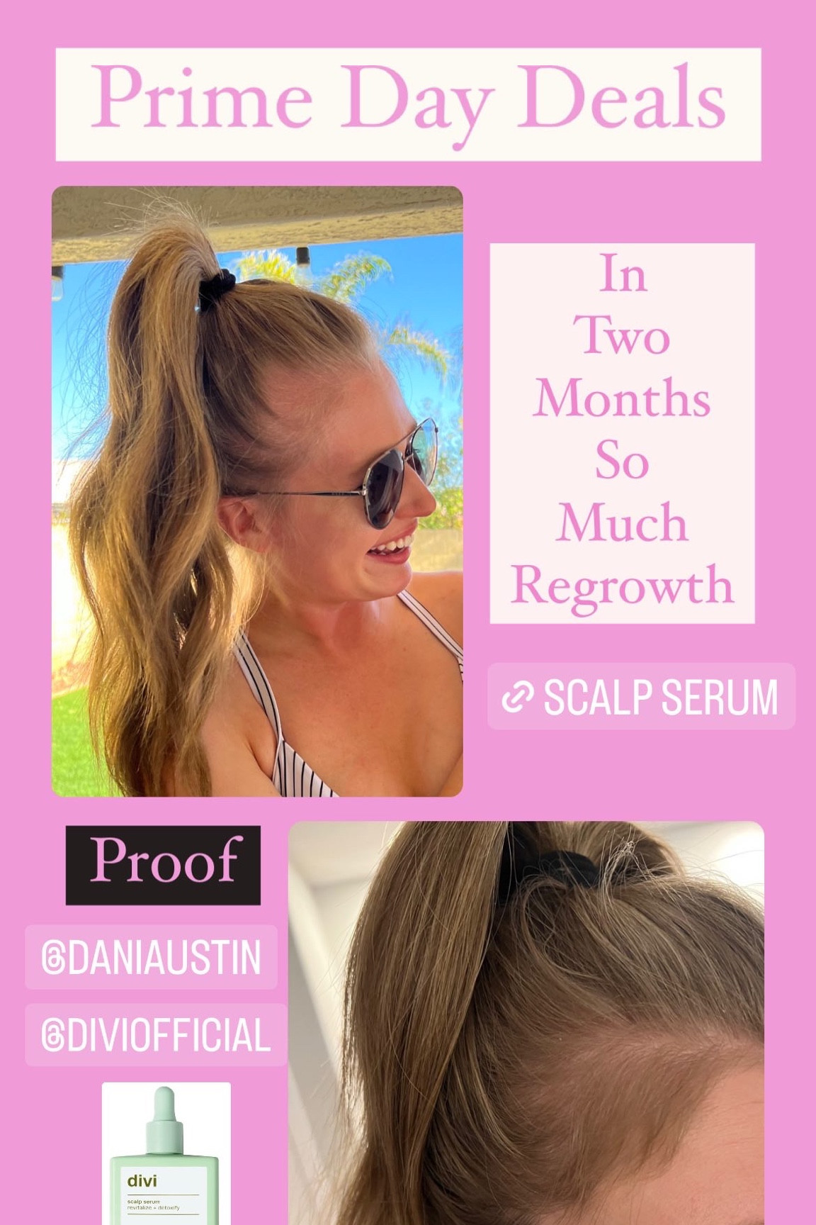 Unlock the secret to luscious locks! 🌟 Shop our scalp serum for hair loss at an exclusive Prime Day price. Say goodbye to hair woes and hello to healthier, fuller tresses. 💁‍♀️ #PrimeDayDeals #HairCare

#LTKxPrime #LTKbeauty #LTKsalealert