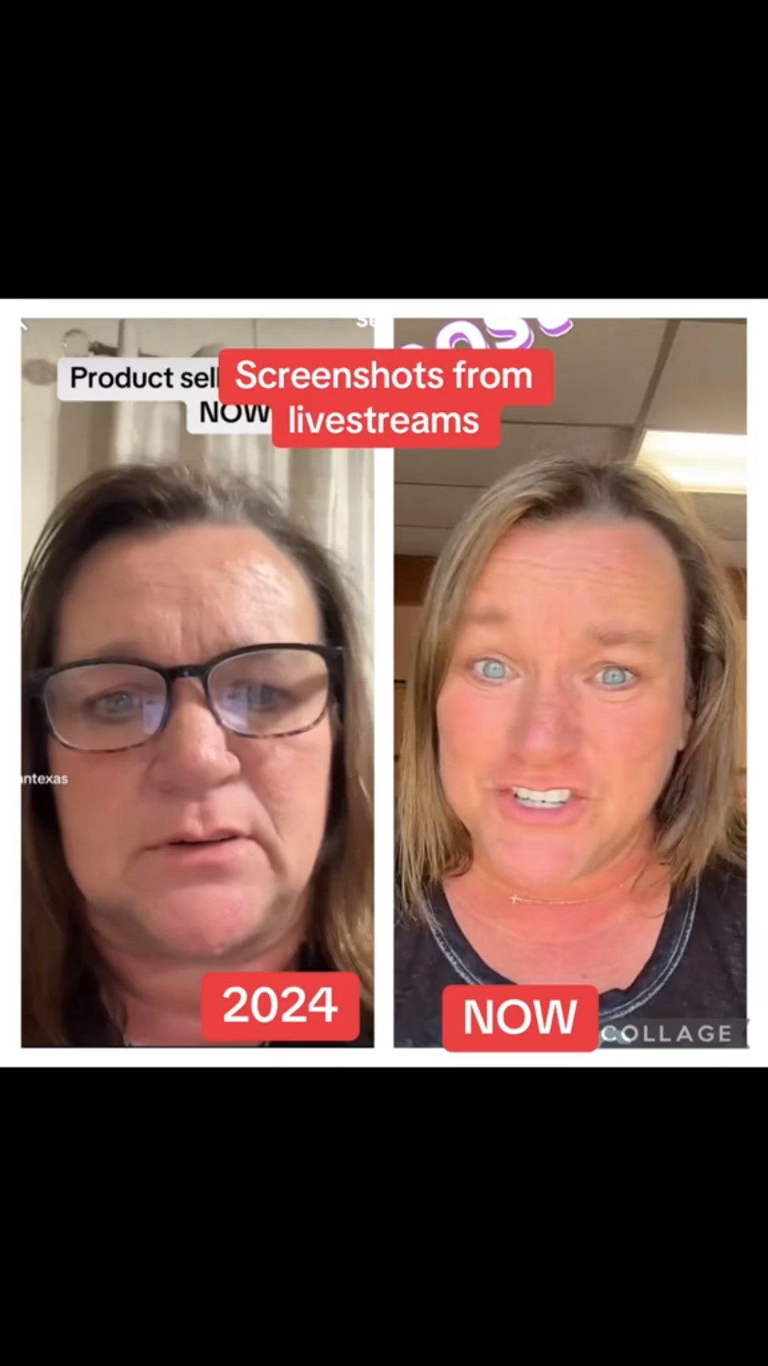 SKIN CARE saved my face!

#LTKBeauty #LTKOver40