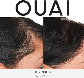 OUAI Scalp Serum - Balancing and Hydrating Serum with Red Clover Extract, Siberian Ginseng and Pe... | Amazon (US)