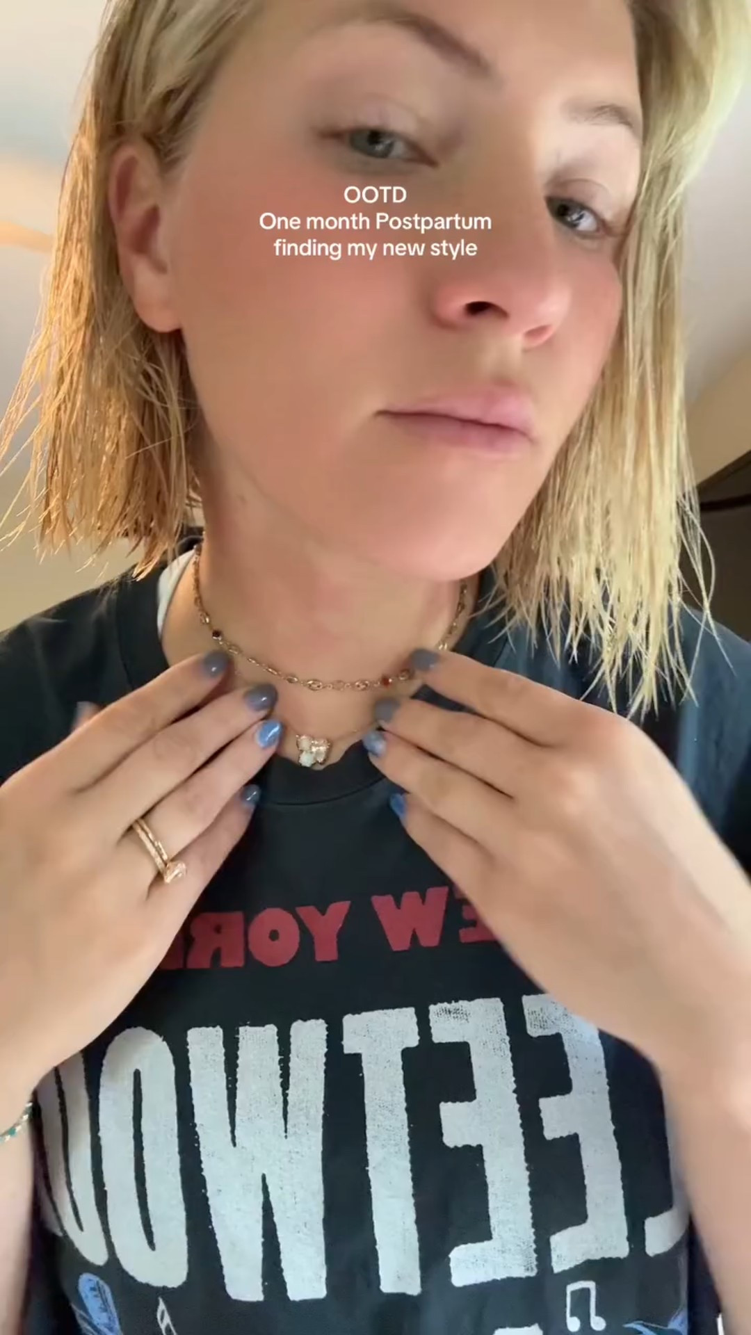 Mom shorts 🤝 oversized tee. OOTD featuring the eczema on my face/neck 😁 #ootd #mom #momstyle #grwm #ltk #postpartum #postpartumbody #fyp