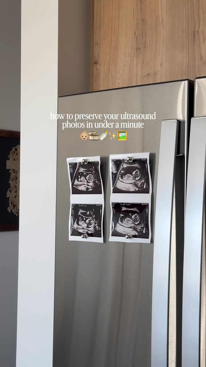 Wish I knew about this hack with my first 🥲

Comment SHOP for a link to everything I used 🔗

— self laminating photo hack, ultrasound photo preservation, ultrasound keepsake, new mom hack | #ultrasound #momhack #homeinspo #motherhood

#LTKHome #LTKBaby #LTKmomlife