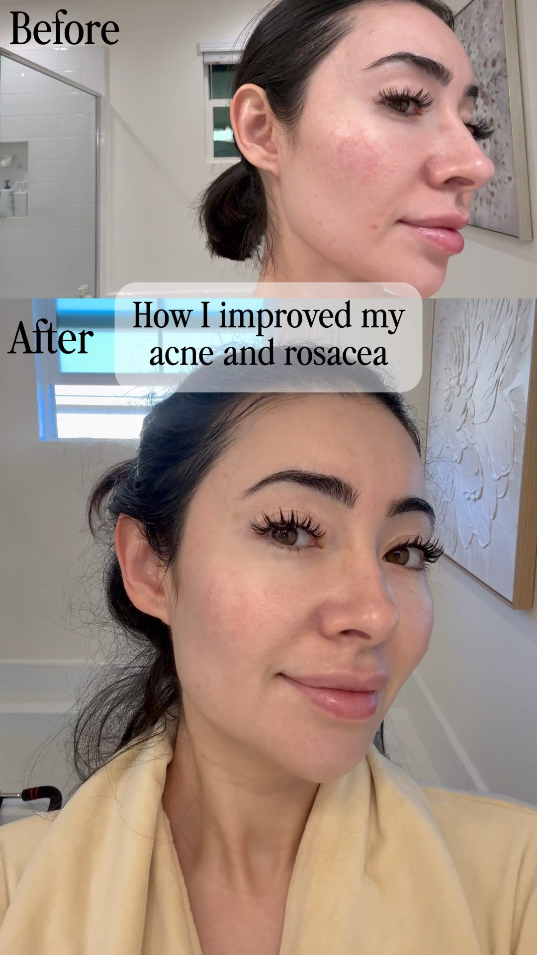 I'm going to save you from wasting money on LED masks that don't deliver real skincare benefits. When you look at the research, you'll see that most cheap masks are just glorified colored lights, unlike the JMOON by Ulike ReGlow Max.

This device offers genuine red light therapy benefits, which I've personally used as part of my rosacea treatment.

Looking for how to get rid of acne? You've come to the right place!

It's a worthwhile investment for anti-aging and overall skin health!

🎥Watch the full review here: https://www.youtube.com/watch?v=6nnLoHhfrg4

🛍️I've linked the products, but l
also have some Ulike website exclusive discounts you can use.

💰COUPON CODES:
• Ulike ReGlow LED Mask: clarissareglow
• Ulike ReGlow Max (foldable version): Clarissa

How to Redeem Code on the Ulike Website:
1. Select the desired product
2. Add it to your cart
3. Remove the default discount code
4. Enter " " at checkout for a special discount
5. Complete your purchase 

#ledfacemask
#redlighttherapyforbodyandface #ulikereglow
#redlighttherapymask #ulikereglowmax LED face mask, red light therapy for body and face, red light therapy mask, ulike reglow, ulike reglow max, JMOON by Ulike ReGlow Max, rosacea treatment, acne treatment, red light therapy for rosacea

#LTKselfcare #LTKmorningroutine #LTKBeauty