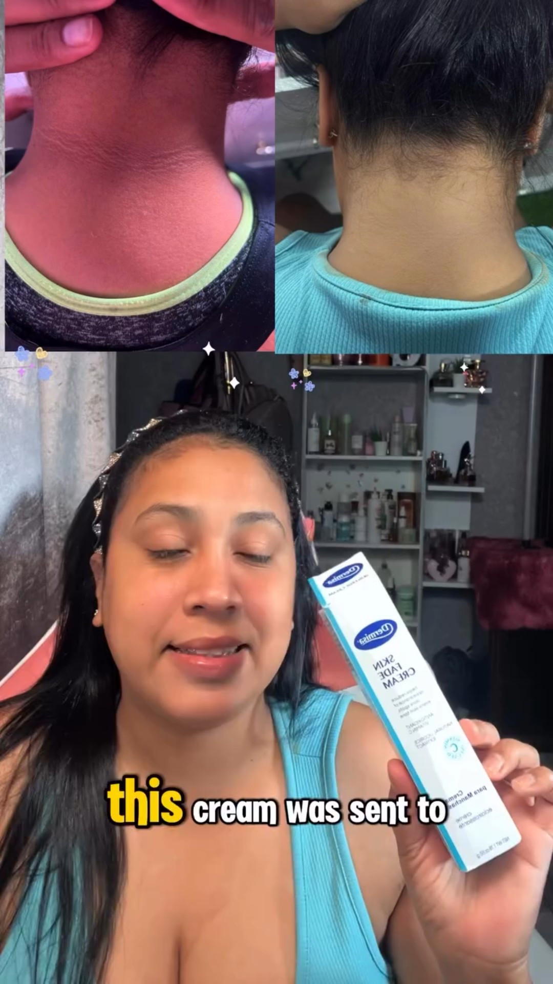 ✨ Skincare that truly makes a difference 💕 With consistency and the right ingredients, your skin can look more radiant and even. 🌸

#dermisaskincare #skinfadecream @dermisaskincareusa

#LTKShoeCrush #LTKFallSale #LTKU
