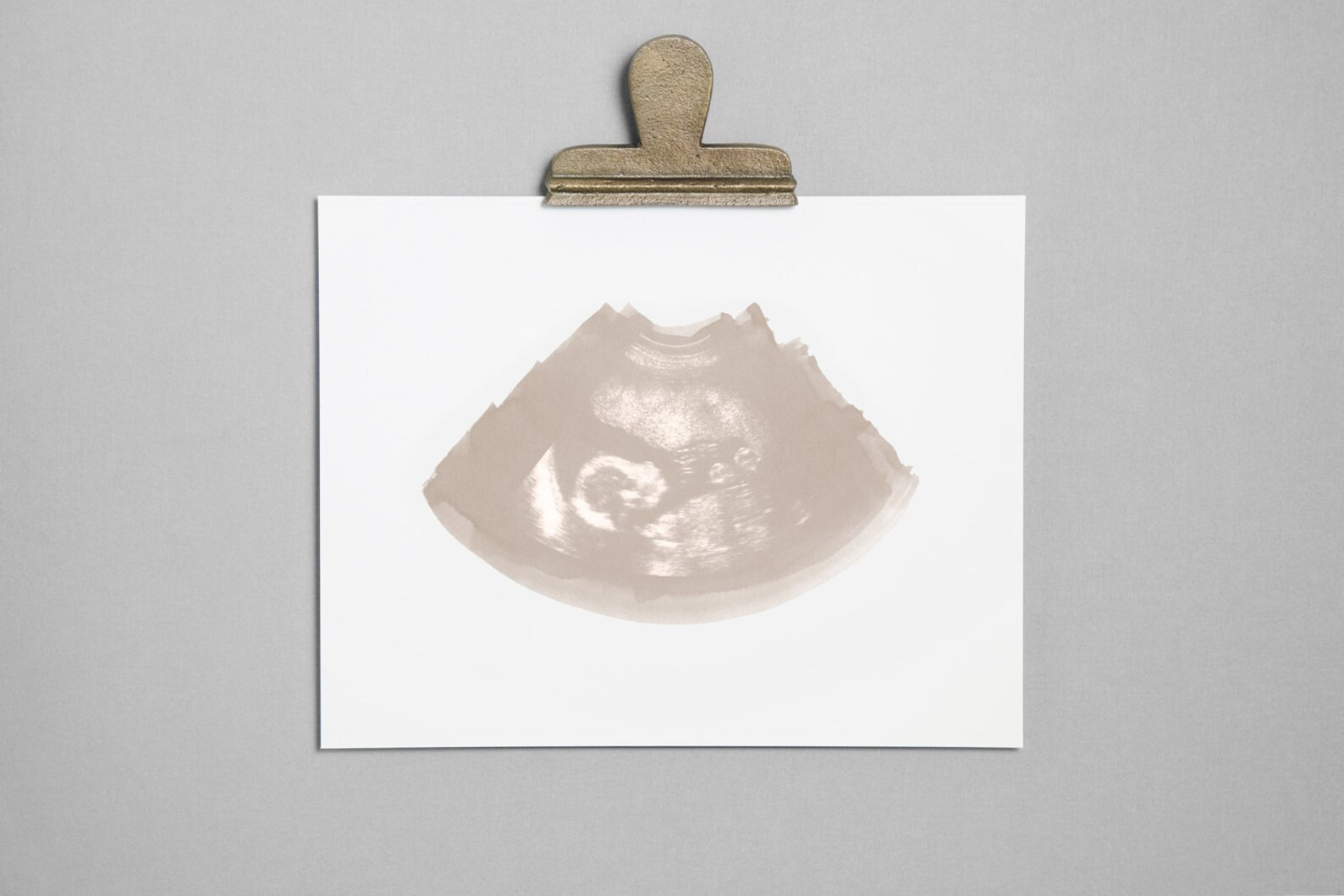 DOVE Ultrasound Sonogram Physical Print - Etsy | Etsy (US)