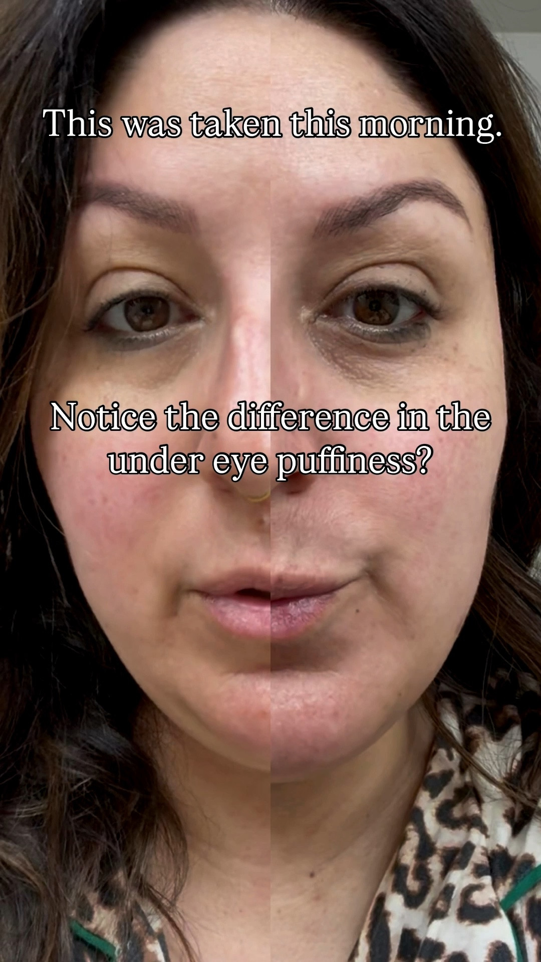 Grace & Stella under eye patches for the WIN!!


#LTKselfcare #LTKBeauty #LTKOver40