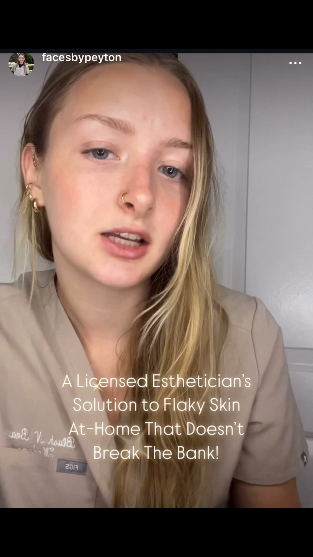 Hyaluronic acid changed the game for my skin—Here’s some affordable and effective options🤍

#LTKFindsUnder50 #LTKStyleTip #LTKBeauty