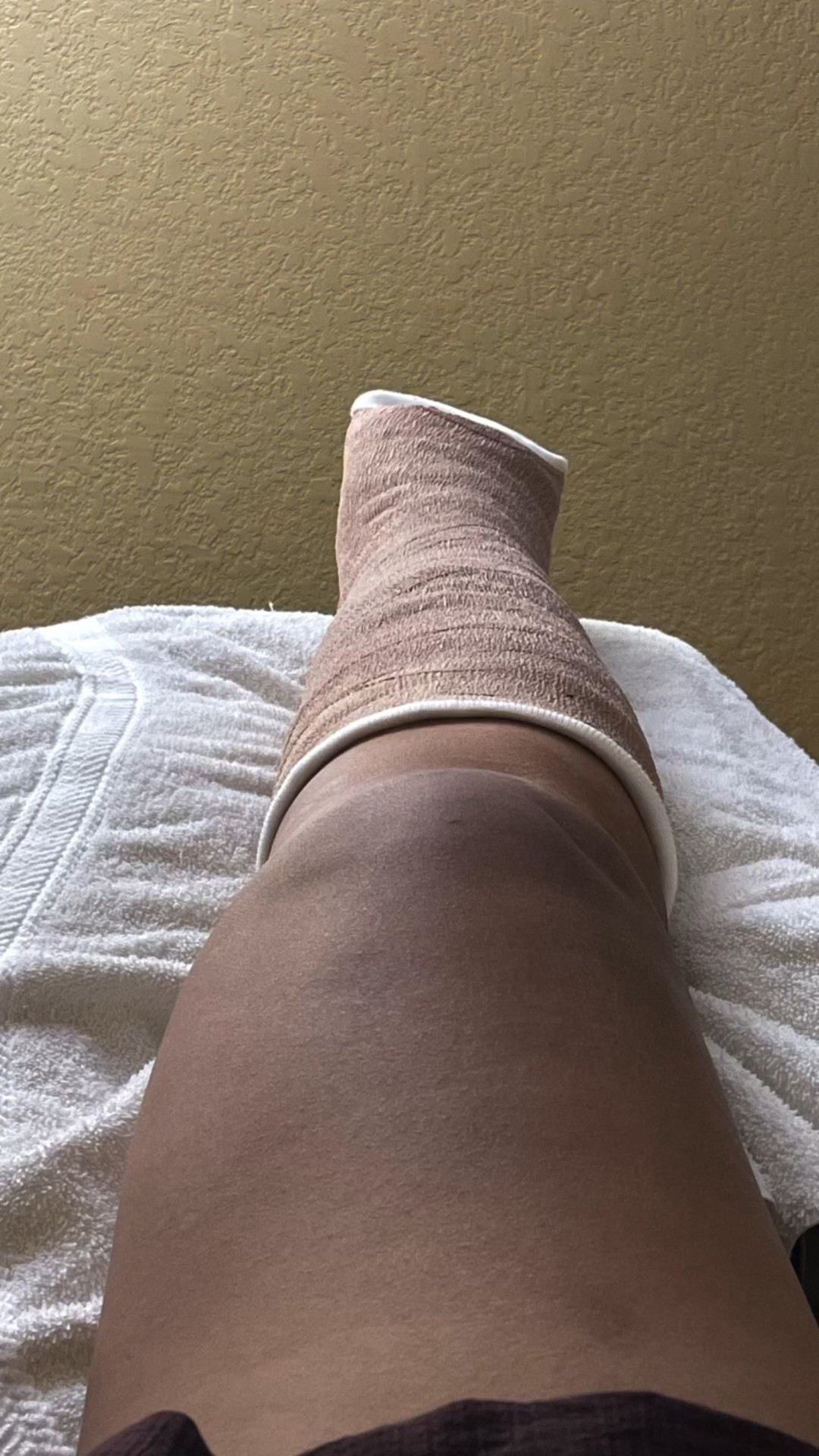 So who’s interested in a recovery vlog series?

I have been dealing with Achilles tendonitis off and on for several years now and I knew this could eventually happen. I just wish it wasn’t now. My husband just started a job (thankfully it’s remote with a bit of flexibility) and now has to juggle all the kid transportation things on top of carrying for me. 

I’m looking forward to the 8-week mark when I gain a little bit for independence back because I’m so used to being on-the-go, especially with the kid stuff. 

I’m fine for now but it did really take a toll on me mentally. The mental blow has so far hurt more than my physical injury but im slowly processing and gaining a bit more clarity and acceptance on this situation. 

Stay tuned while I try to figure out how to incorporate LTK into this journey as well!

#quintocreations #achilliesrupture #injuryrecoveryprocess

#LTKOver40 #LTKHome #LTKmomlife