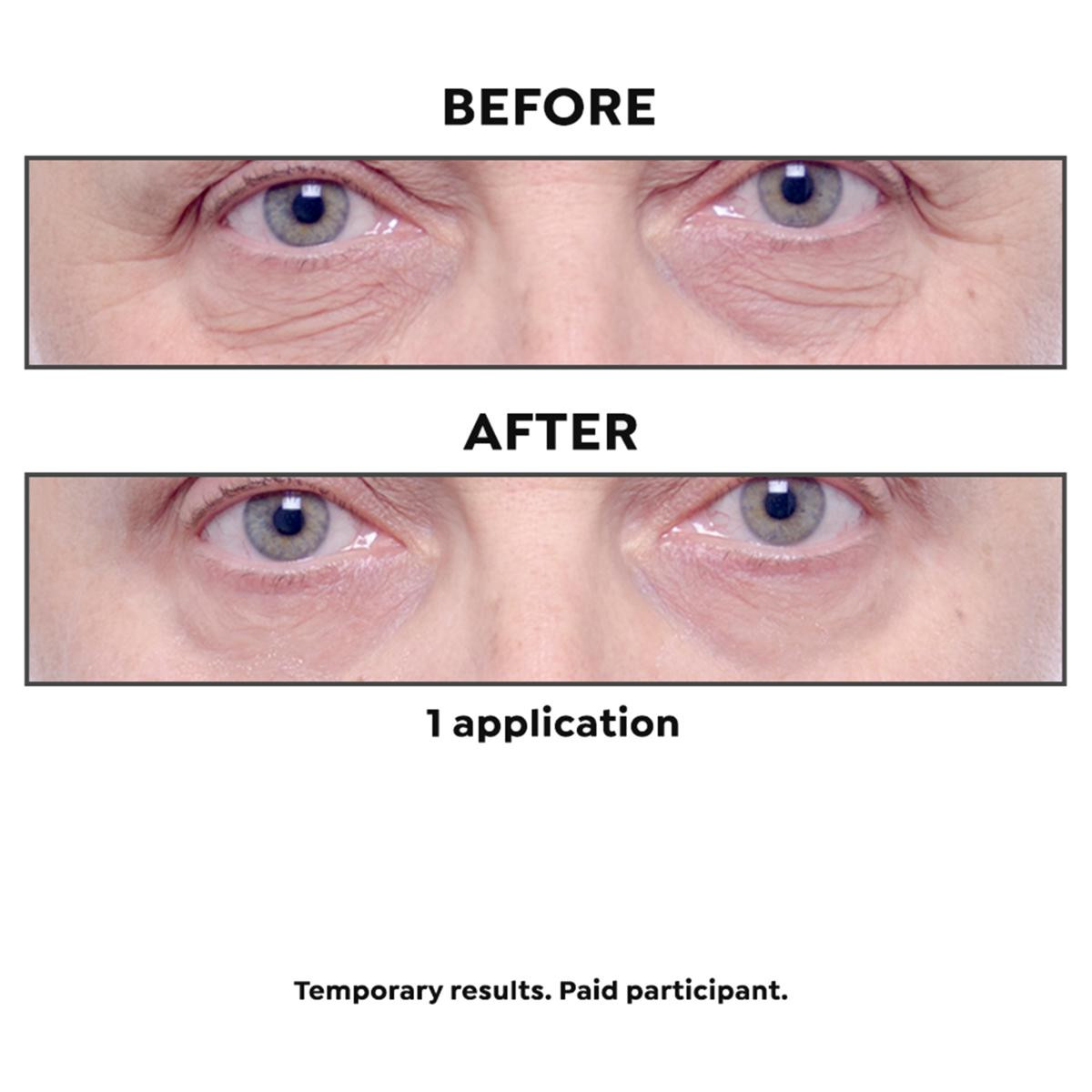 Black Rice Platinum Eye Contour Serum | HSN | HSN