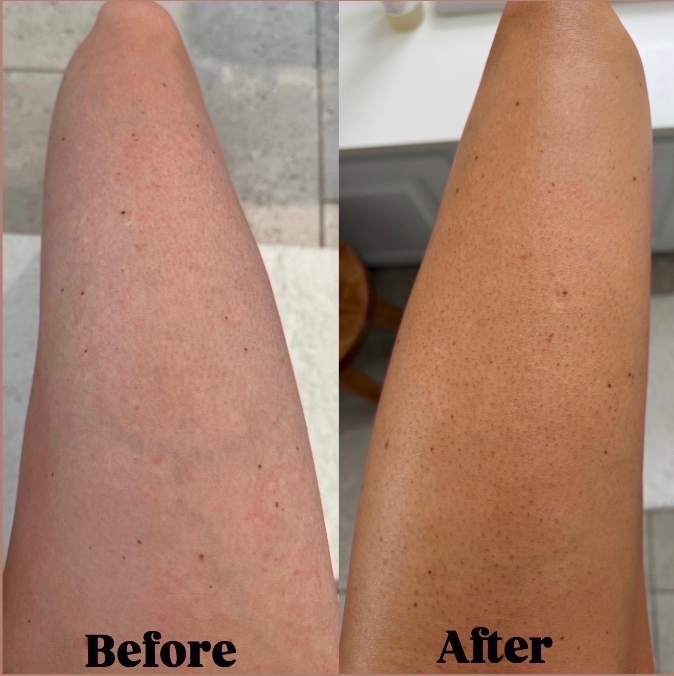 My favorite goto self tanner is 25% off today through Monday! (Code ‘Prime25’) No smell, not sticky and a clean formula. It doesn’t transfer at all and looks so natural ☀️ 

Get into the limelight, tanning mousse, self tanner, beauty must have, beauty products, nighttime routine, summer must haves, glowing tan

#LTKSaleAlert #LTKselfcare #LTKBeauty