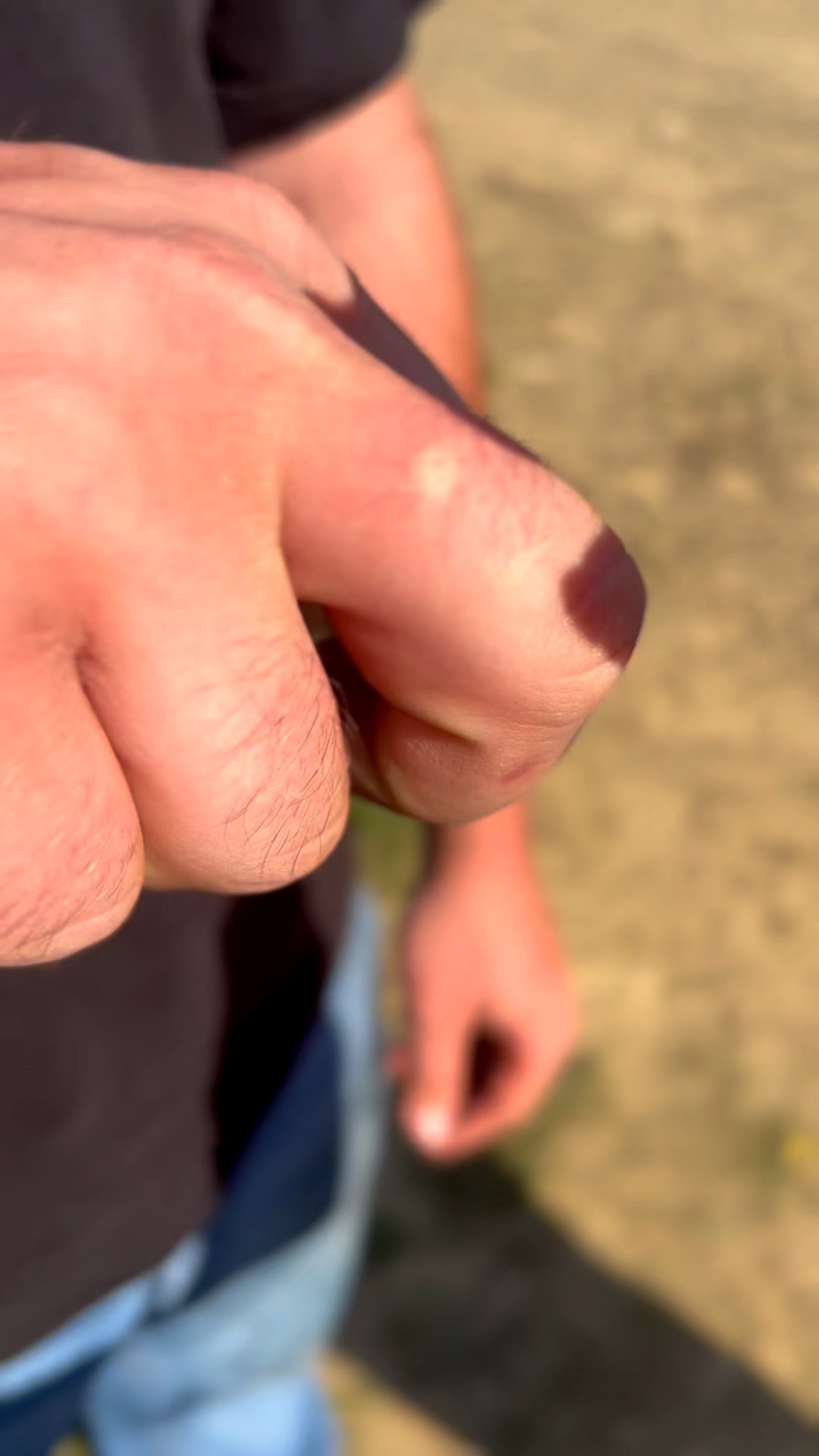 Bug Bite Thing—fast relief from mosquito and insect bites. A must-have for farm life.  It’s not bug season yet but it’s approaching quickly..  get yours ordered now before they sell out again! 

#LTKSaleAlert #LTKdayinmylife #LTKselfcare