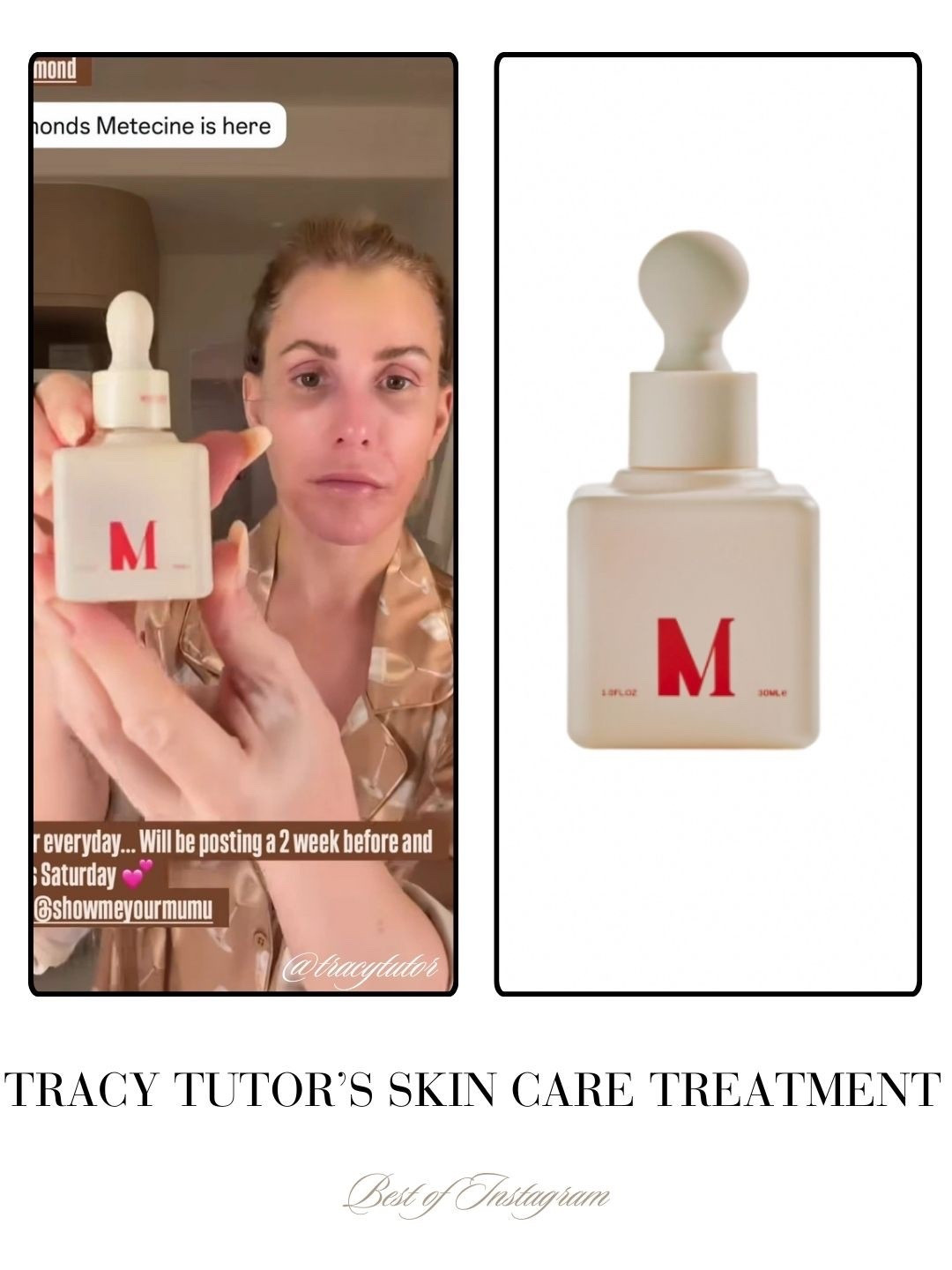 Tracy Tutor’s Skin Care Treatment 📸 + ID = @tracytutor