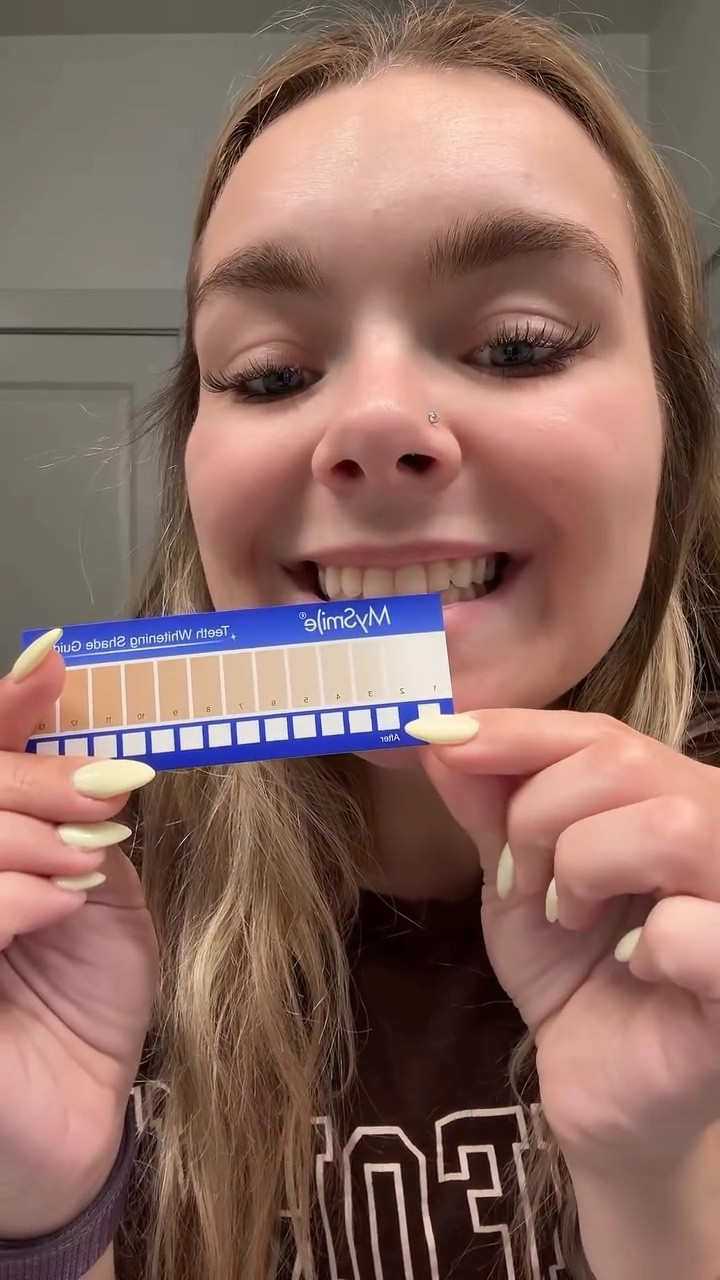 MySmile Professional Teeth Whitening Strips  Day 1 Results! ✨ Already seeing a brighter smile after just one treatment!! I’m doing the full 5-day Pro Whitening + 2 Express Strips this week. Can’t wait to share the full before & after results! 💎 If you’ve been searching for an at-home teeth whitening kit that actually works, this might be it! 

follow @mysmile
@mysmile @mysmileusa @stackinfluence #mysmile #mysmilepartner #MySmileusa #glowup #smilegoals  #amazonfinds #beautyroutine #whiteningstrips #mysmileteethwhitening