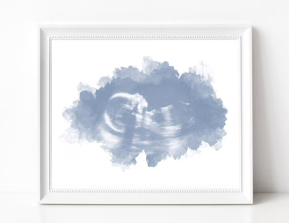 Watercolor Ultrasound Art Print, Baby Shower Gifts, Gender Reveal, Name Reveal, Sonogram Gifts, C... | Etsy (US)