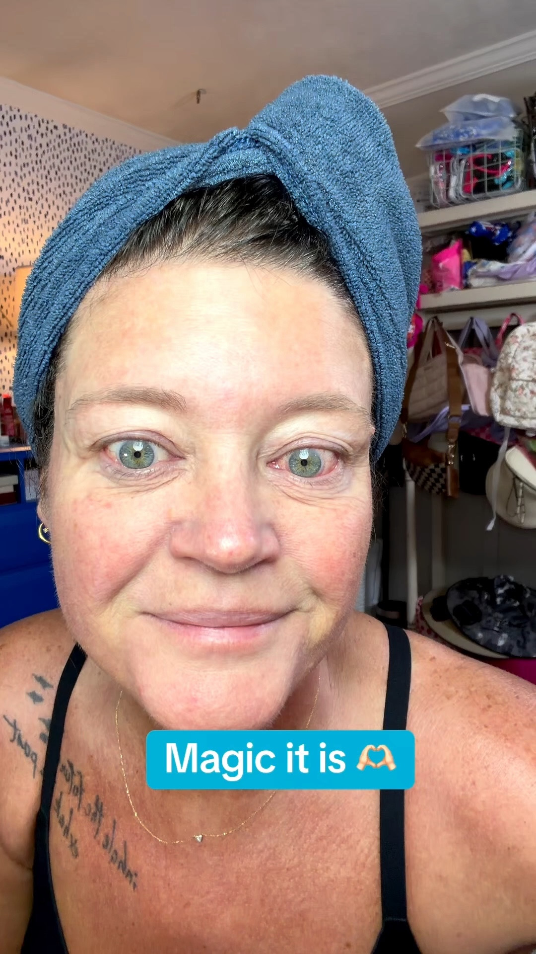 The best eyedrops!!!! #lumify

#LTKOver40 #LTKselfcare #LTKmorningroutine