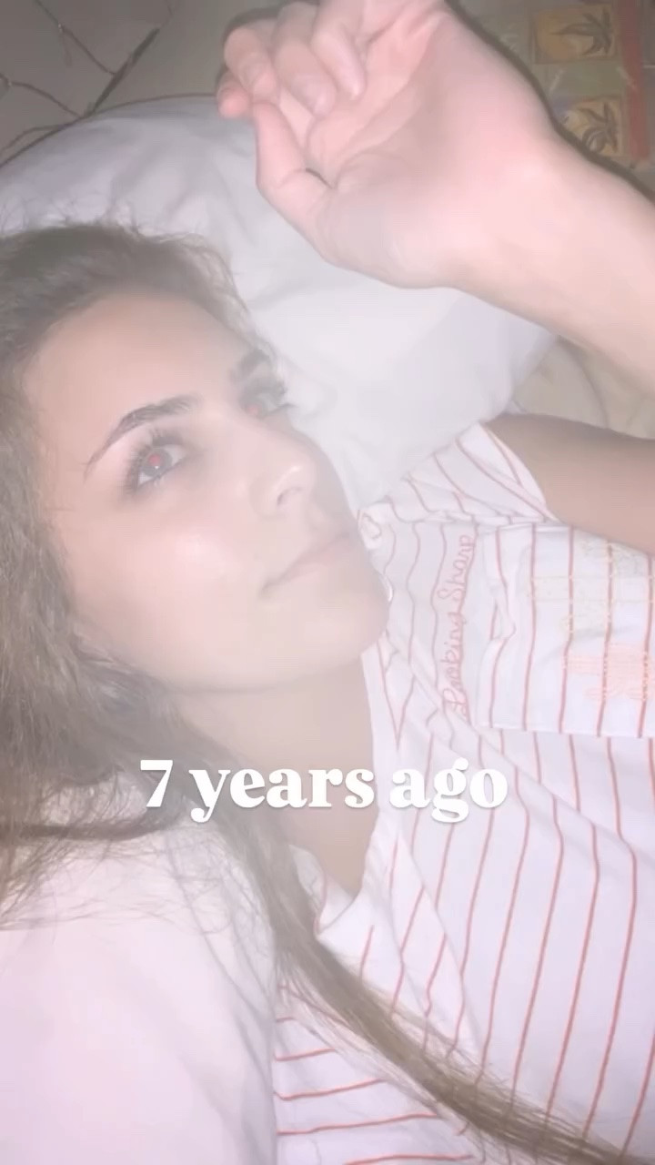 7 years ago I started taking care of my skin…and never looked back🥹☺️ comment “GLOW” for details ✨#skincare #lifestyle #throwback #glow #model