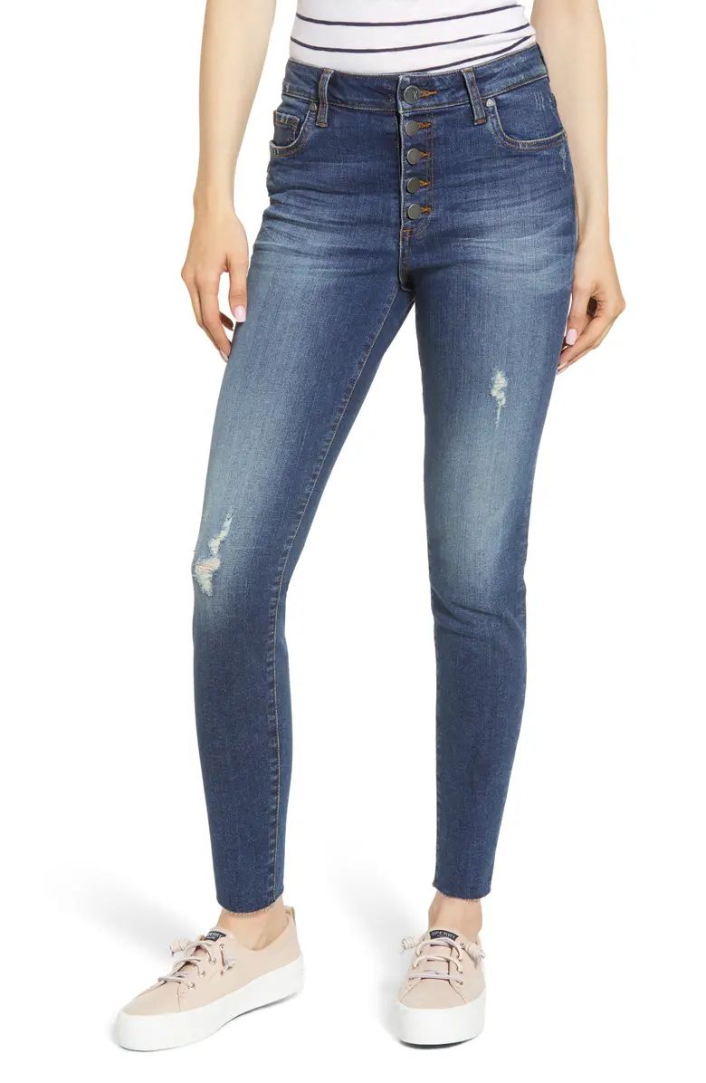 KUT from the Kloth Donna Button Fly Ankle Skinny Jeans (Touched) | Nordstrom | Nordstrom