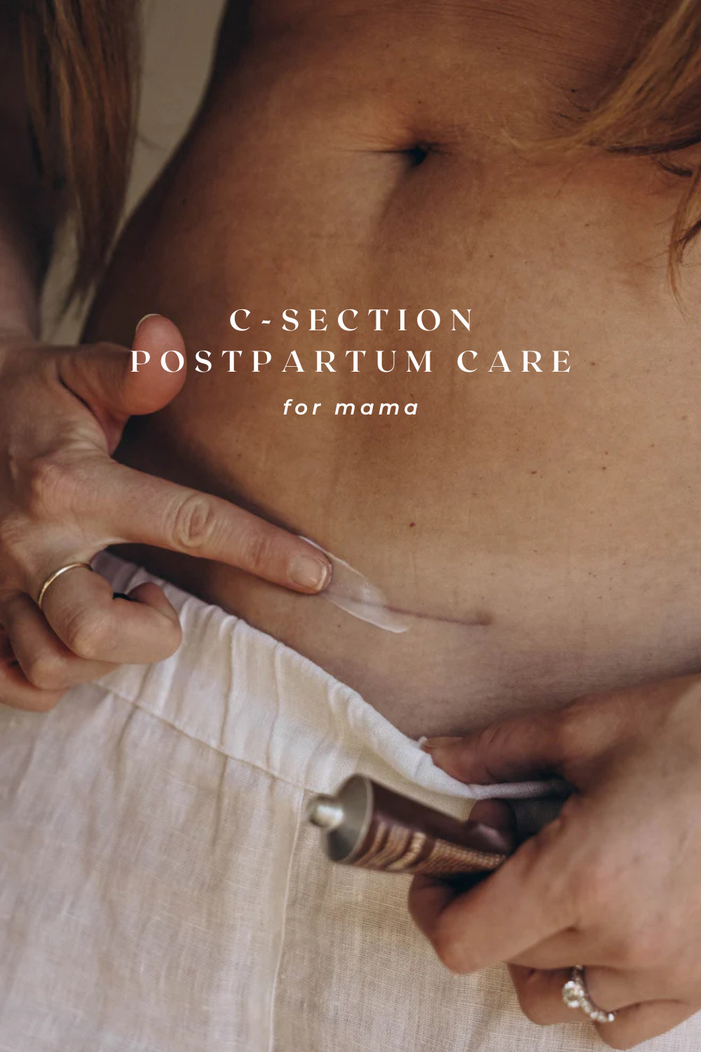 If you’re having a C-section (or just want to be prepared), this is your reminder to take care of YOU too 🤍

No one talks enough about recovery after a C-section — but having the right postpartum essentials can make a huge difference in healing, comfort, and confidence.

Think: scar care, high-waisted underwear, belly support, gentle skincare, and healing must-haves you’ll actually use daily.

Saving this now = one less thing to stress about later ✨
Shop all my tried-and-true C-section postpartum care favorites linked here. 

 

#LTKmomlife #LTKBaby #LTKBump