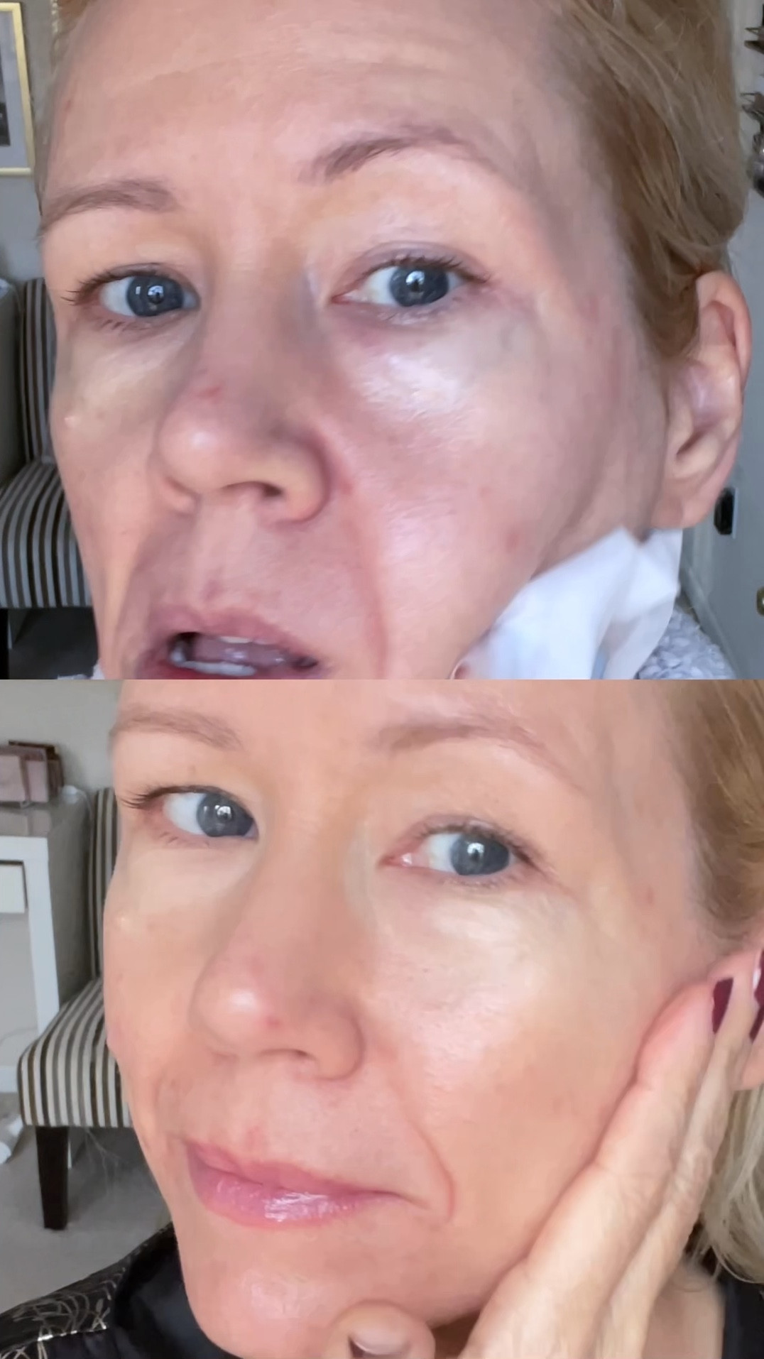 I could not believe my eyes how much these have transformed my skin in only 7 days! This one-step, triple-action peel will help “shed” some light on younger-looking, more radiant skin with three pre-dosed actives that, as part of your daily skincare regimen, will result in brighter, smoother, tighter and younger-looking skin with a more radiant surface glow! 

#LTKBeauty #LTKWatchNow #LTKOver40