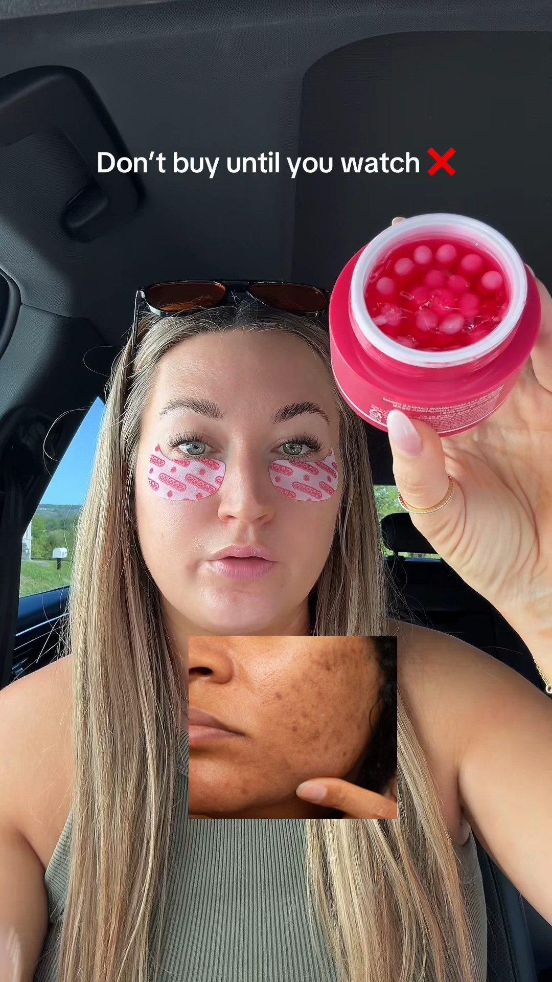 I didn’t get the hype until my dark spots stopped distracting #skincaretok #ad

https://www.tiktok.com/@allyshopsalot/video/7635764987574701325?is_from_webapp=1&sender_device=pc&web_id=7595868255789630984 

 