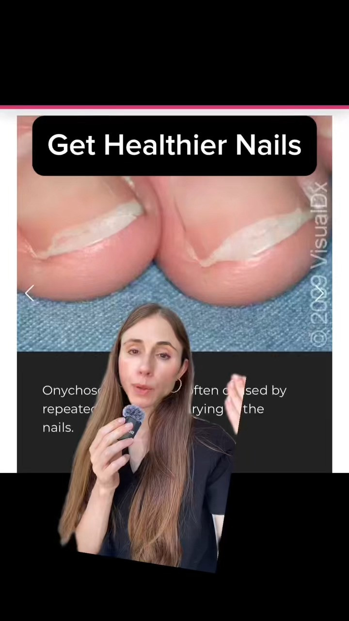 Fix Nail Splitting FAST #nailcare 

 #LTKBeauty