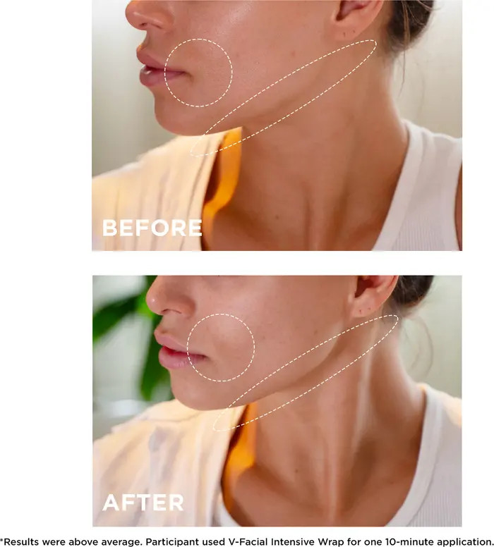 V-Facial Instant Depuffing Face Mask | Nordstrom