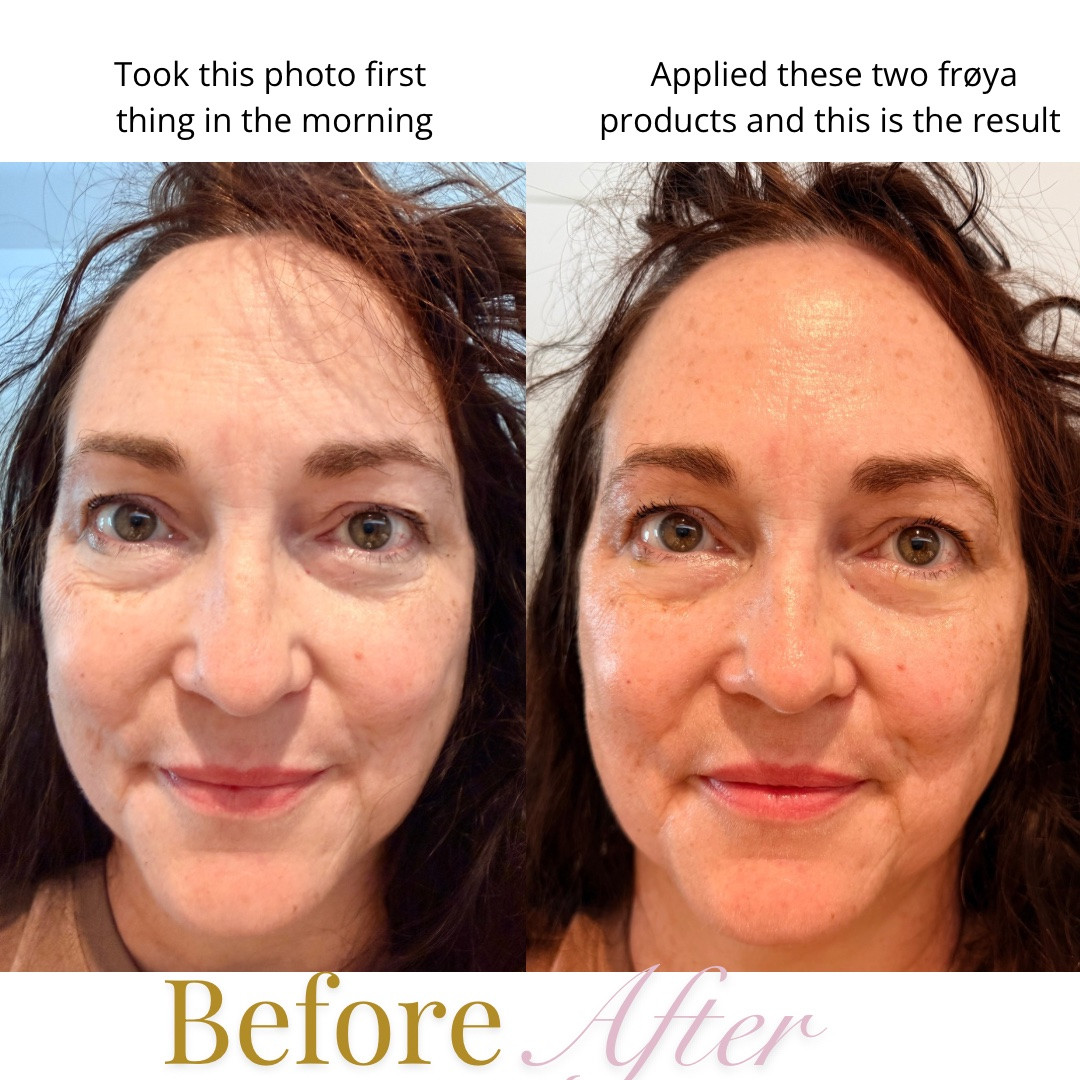 Check out this side by side before and after comparison. This is five minutes apart in the exact same lighting and look how my skin is glowing. Reduce appearance of fine lines. Help increase collagen and lessen dark under eye circles. Yes, please!

#LTKmorningroutine #LTKOver40 #LTKBeauty