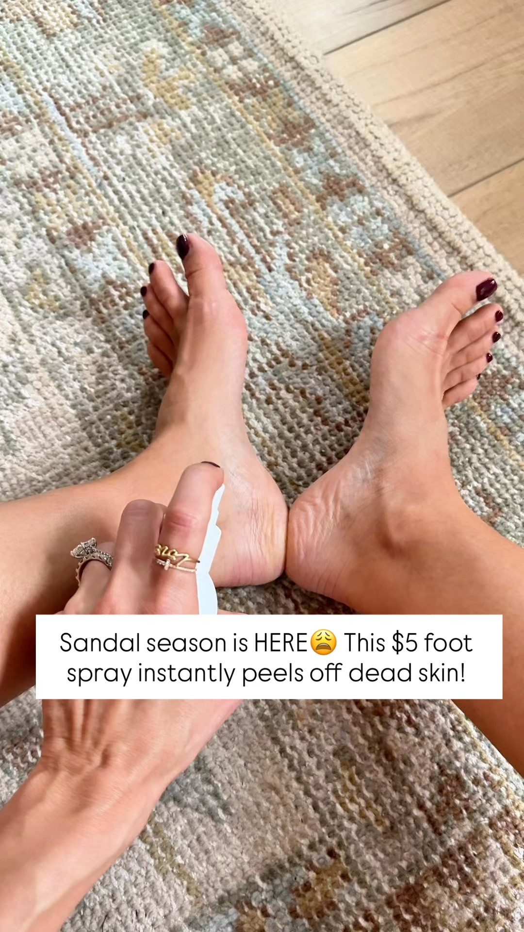 This foot spray is so gross but it WORKS! I spray the bottles of my heels and rubs them and the dead skin will instantly peel off. The best $5 you will spend! 


#LTKBeauty #LTKmorningroutine #LTKselfcare