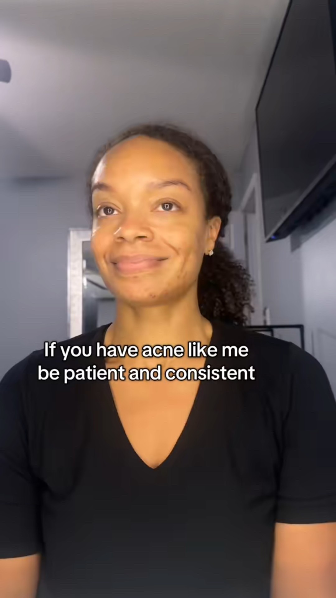 These have been a game changer for my acne scars. #skincare 

#LTKBeauty #LTKStyleTip #LTKHome