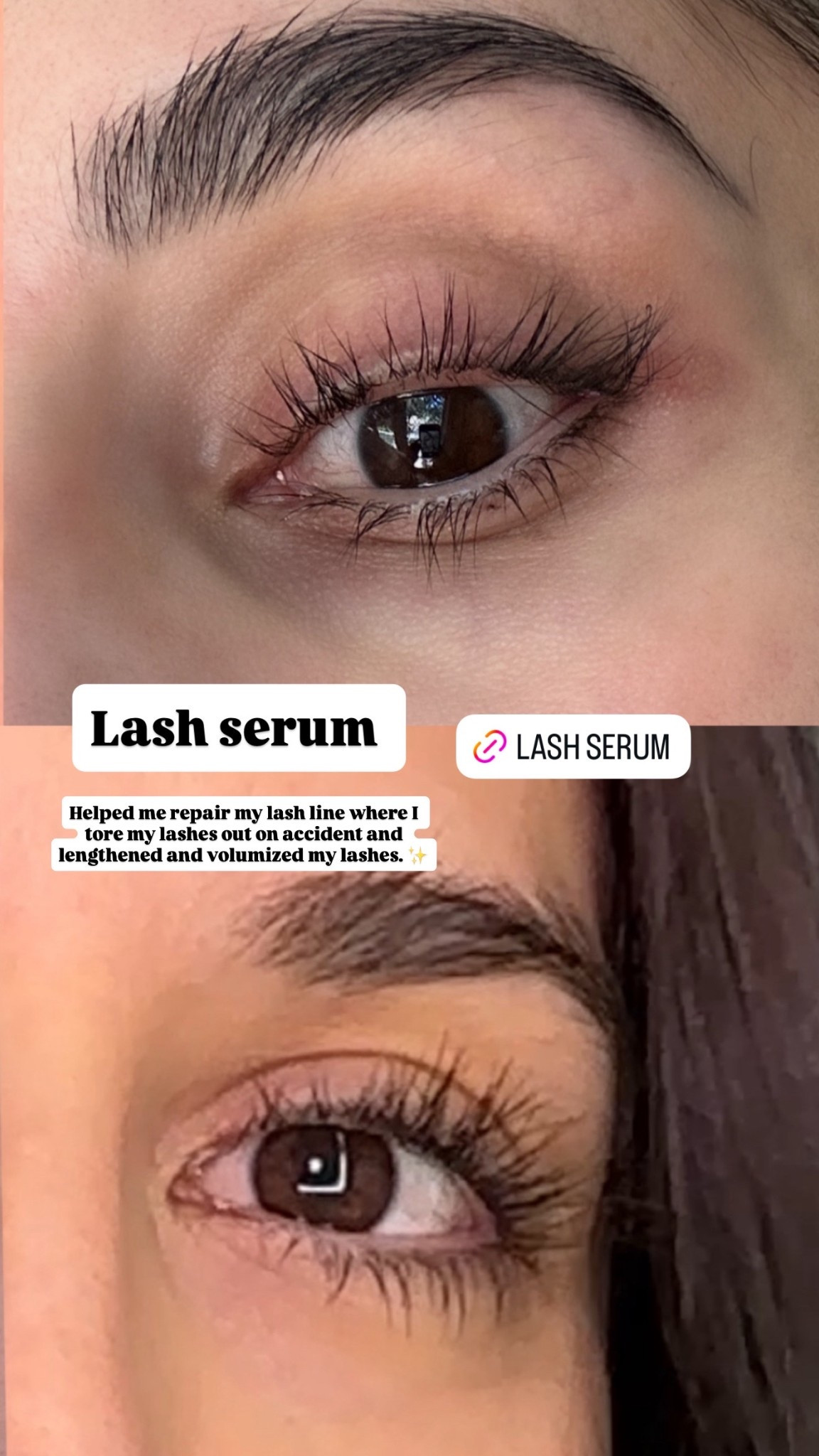 Lash serum #lashes #lashserum

#LTKootd #LTKmomlife