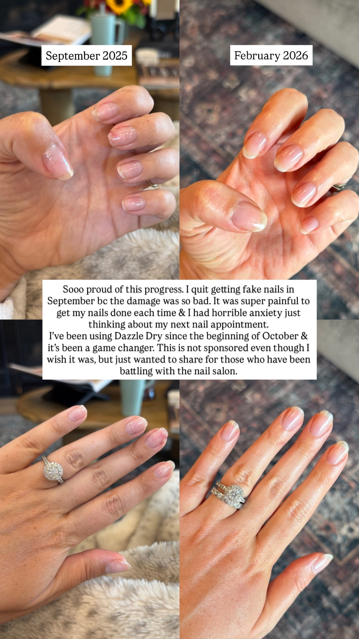 Natural nail journey. We have made sooo much improvement. My nails are strong, finally growing, & feel sooo much better. I paint my nails once a week using the  @Dazzle Dry system 

#LTKBeauty #LTKselfcare