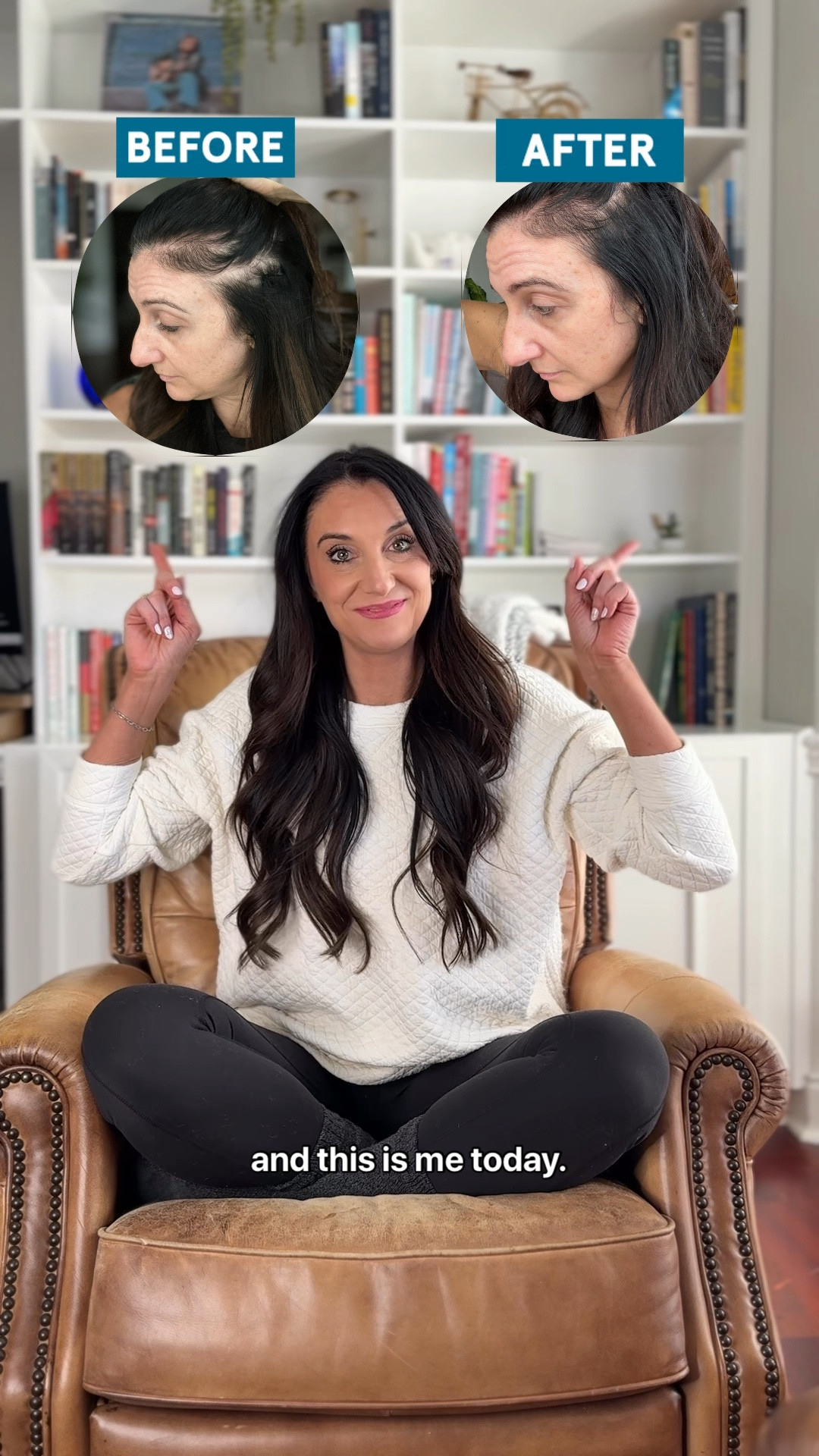 I was shook at how well these products actually worked! Highhhhhlllyyy recommend the brow gel is you’re a thinning eyebrow girly like me 🤪

#LTKBeauty