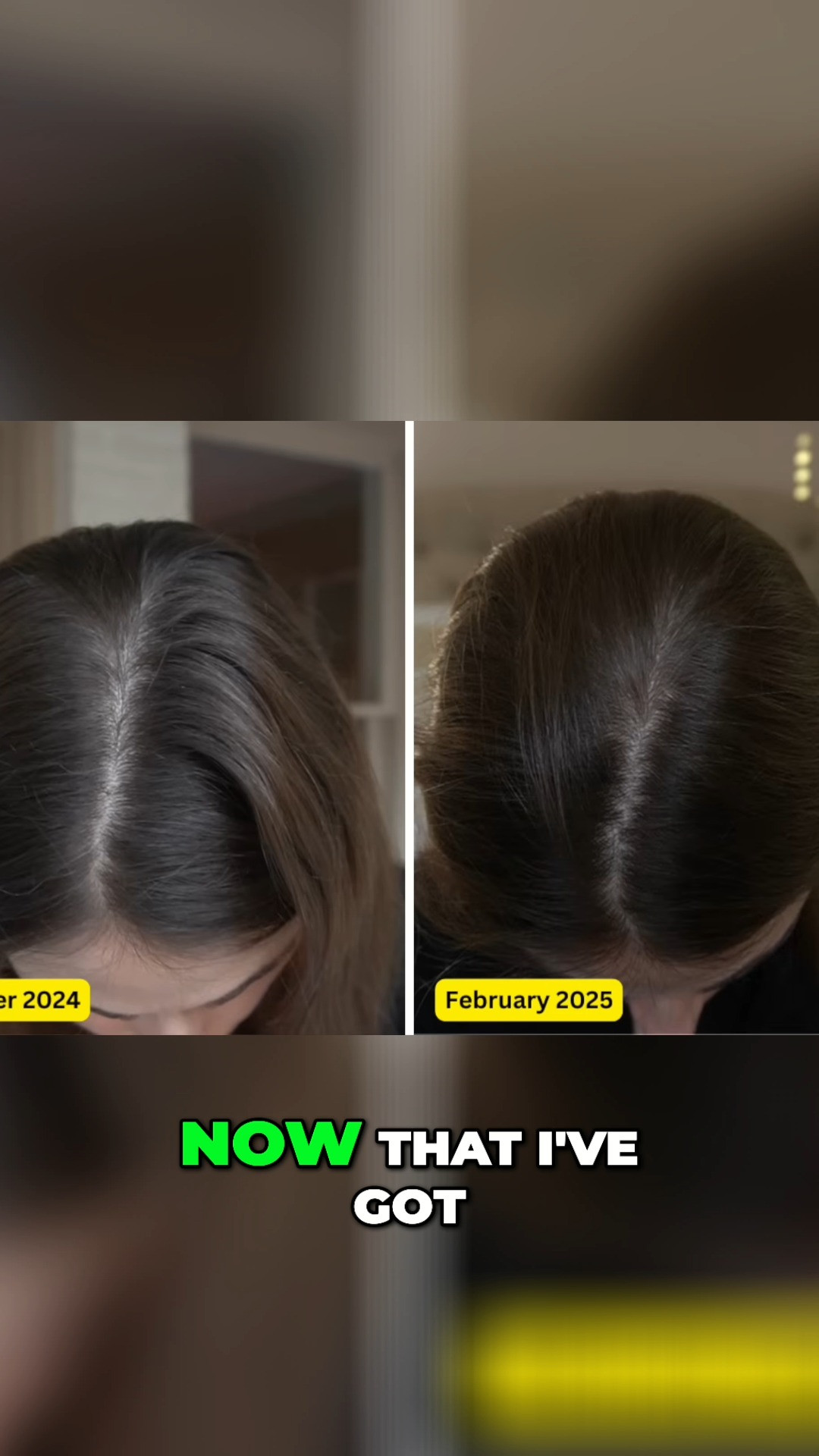 iRESTORE Elite Low Level Laser Hair Regrowth System 

 #LTKGiftGuide #LTKBeauty