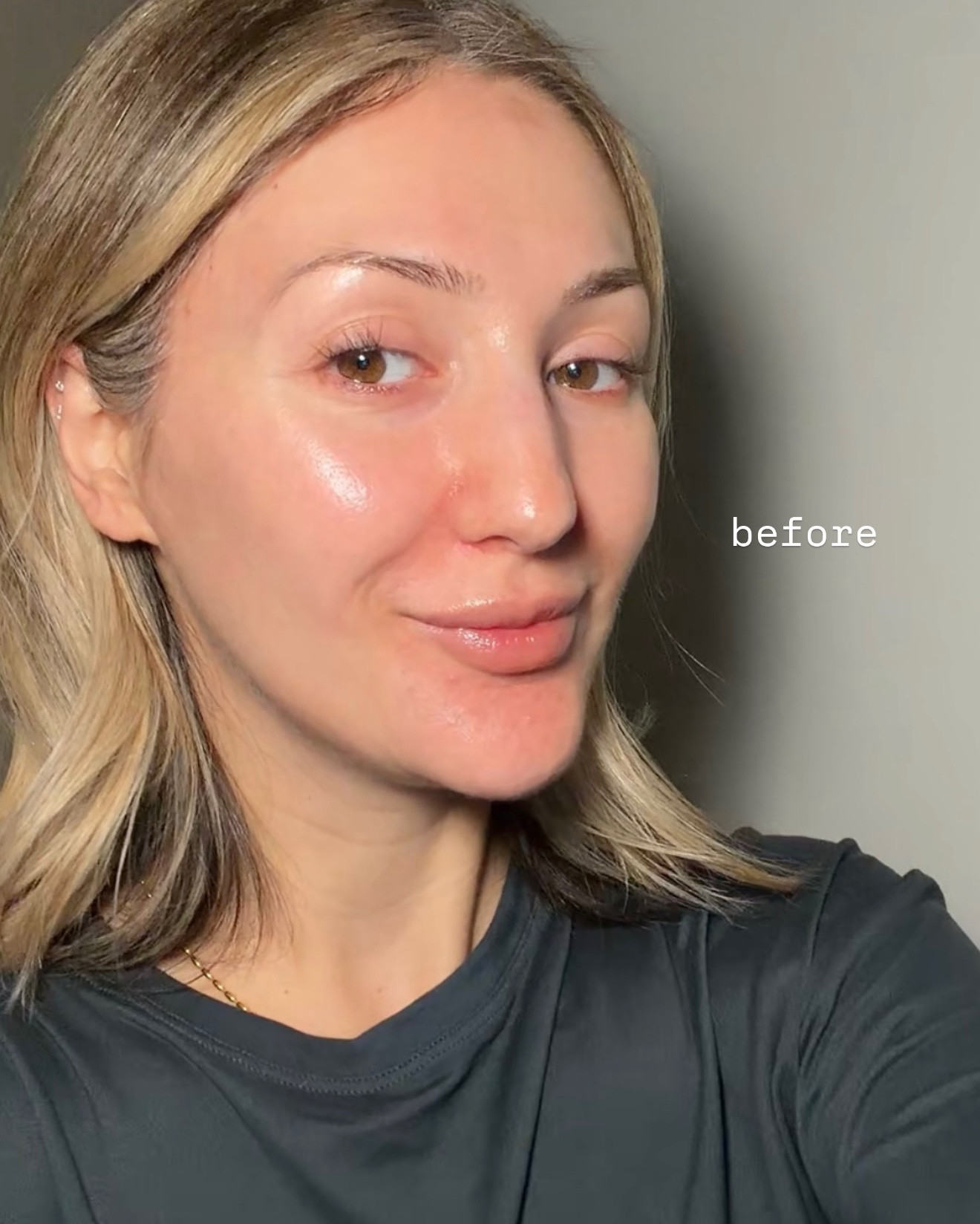 Before (Day 1 of using) ➡️ After 6 weeks of committing to RATIONALE’s Evening Ritual, you can see how much more even and calmer my skin tone is, especially around my T-zone. Cannot recommend their products enough!! And let’s not forget the healthy glow✨

Here’s what my PM routine looks like:
#4 The Cleanser supports the skin barrier with ceramides and intercellular lipids, so it makes your skin feel clean but still comfortable. No tightness, no stripping — made my skin feel soft and hydrated. 

#5 The Serum gently recalibrates the skin’s pH with hydroxy acids, encouraging natural cellular renewal and improving clarity over time. This step has been a game-changer for my texture. It now feels smoother, clearer, and gives that subtle brightness by morning without irritation.

#6 The GelCrème supports overnight repair with Bakuchiol, enhancing radiance and visible firmness without overwhelming the skin. I love this as a pregnancy-friendly night option. It’s lightweight, hydrating, and helped my skin look more even and refreshed by morning — without using traditional retinoids. 

They also have the #6 the night creme which I plan on switching to post pregnancy! 

@rationale #RATIONALEglow #TheEssentialSix #LetItGlow #LuxurySkincare #ad 

#pmskincare #skincareroutine 


#LTKBeauty #LTKselfcare #LTKBump
