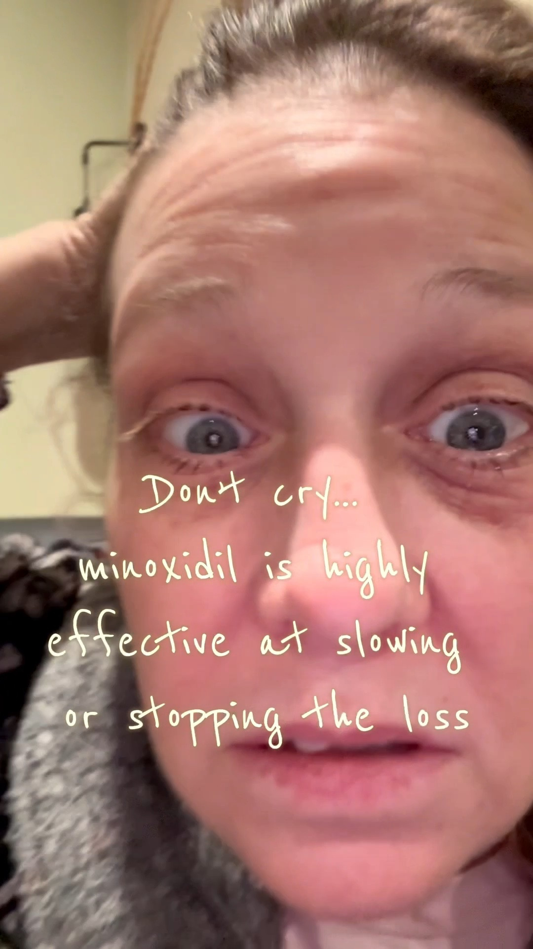 Don't let a widening part or thinning crown affect your confidence. Minoxidil is a science-backed essential for targeting hair loss at the root, helping to revitalize follicles and encourage new growth. It’s an easy, daily step that supports fuller hair and long-term scalp health through hormonal changes.

#MenopauseHairLoss #HairThinning #Minoxidil #ThickerHair #MidlifeBeauty #HairGrowthTips #BeautyOver50

#LTKstorytime #LTKOver40 #LTKBeauty