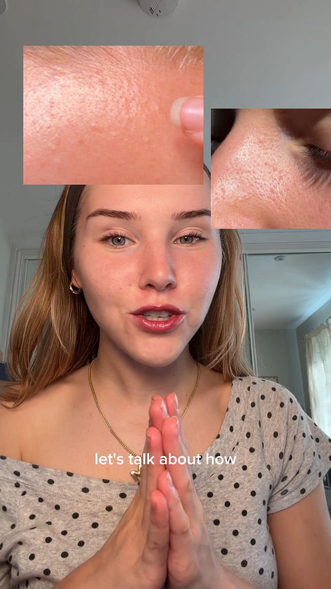 HOW TO CLEAR FUNGAL ACNE!! 

code YESMILS gives ££ off YesStyle (not an affiliate code)