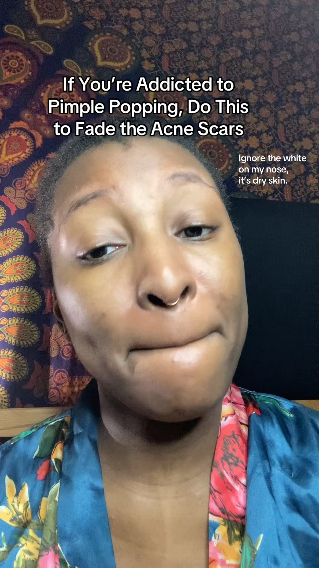 Perfect if you have dark spots or hyperpigmentation. It’s hydrating and has hyaluronic acid   

#LTKBeauty #LTKmorningroutine #LTKgrwm