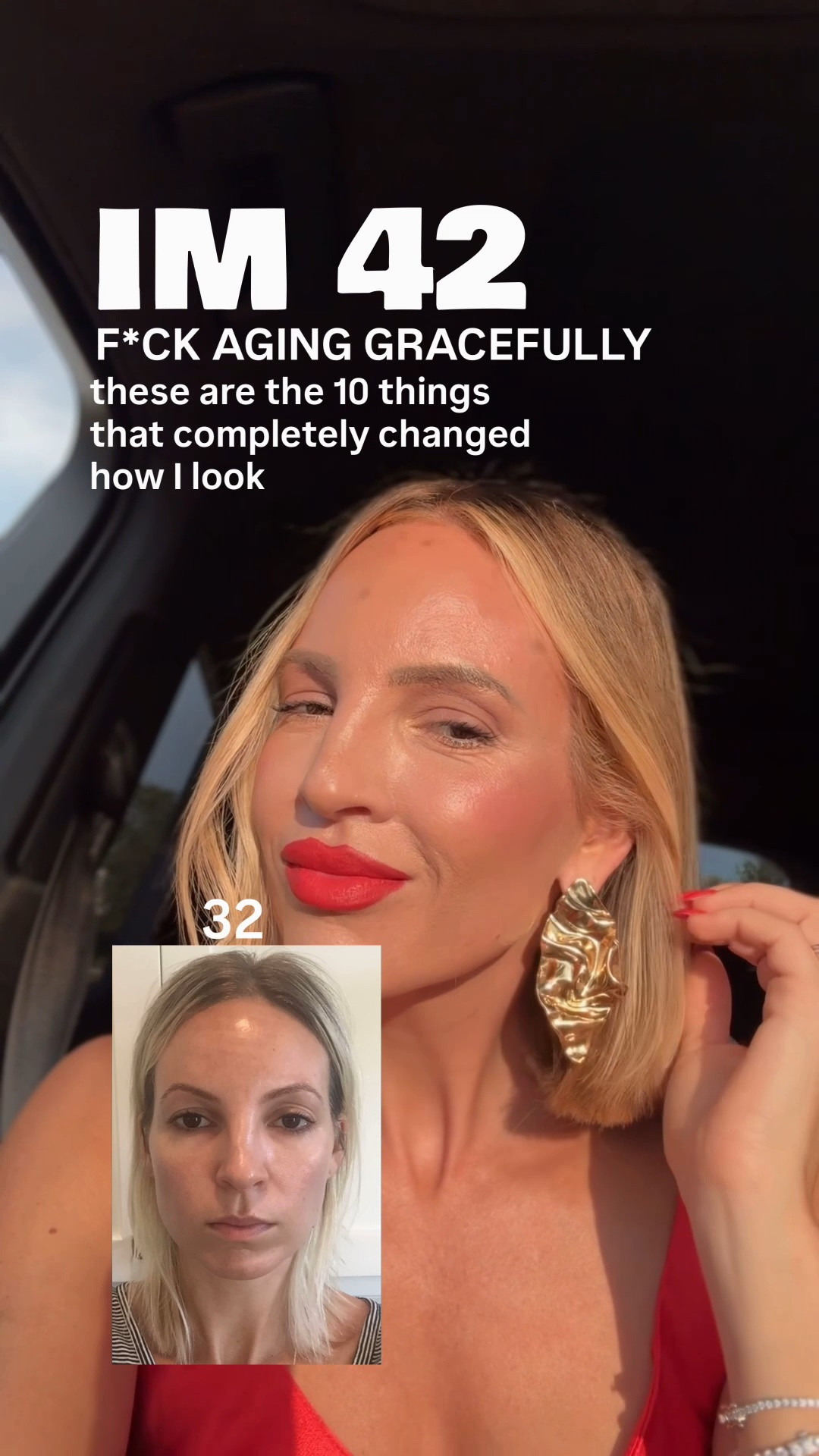 My Yearly Treatment Plan🥂

Every 3 Months
* Botox
* Microneedling with PDGF 4x a year

Twice a Year
* CoolPeel Laser

Once a Year
* XERF
* IPL
* Teeth Whitening

As Needed
* Sculptra
* Lip Filler
* Teeth Bonding (maintenance) 

Weekly
* LED light 

Xerf
For years, I avoided radiofrequency because I was concerned about facial fat loss. XERF was the first RF treatment I felt comfortable trying because it’s designed to deliver energy to the SMAS layer—the structural support layer beneath the skin—to stimulate collagen remodeling and improve skin laxity. It gave me the jawline definition I was looking for without surgery. It’s also become one of Kim Kardashian’s favorite treatments.

melasma - if you're struggling with this, you must try the Obagi Nu-Derm Clear.
I can't link it because you need a script for it. Mix it with your tretinoin! I will link the one that is not a strong and you don't need a script for, but it will take longer to work.
Also keeping the sun off your face and avoiding heat is key.

*linked my favorite makeup products I use every day and skin care products. ￼

#LTKOver40 #LTKstorytime #LTKBeauty